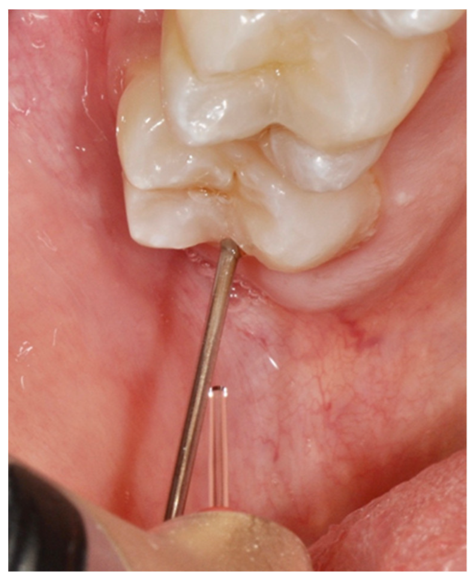 Dentistry 08 00128 g004 Dentistry 08 00128 g004