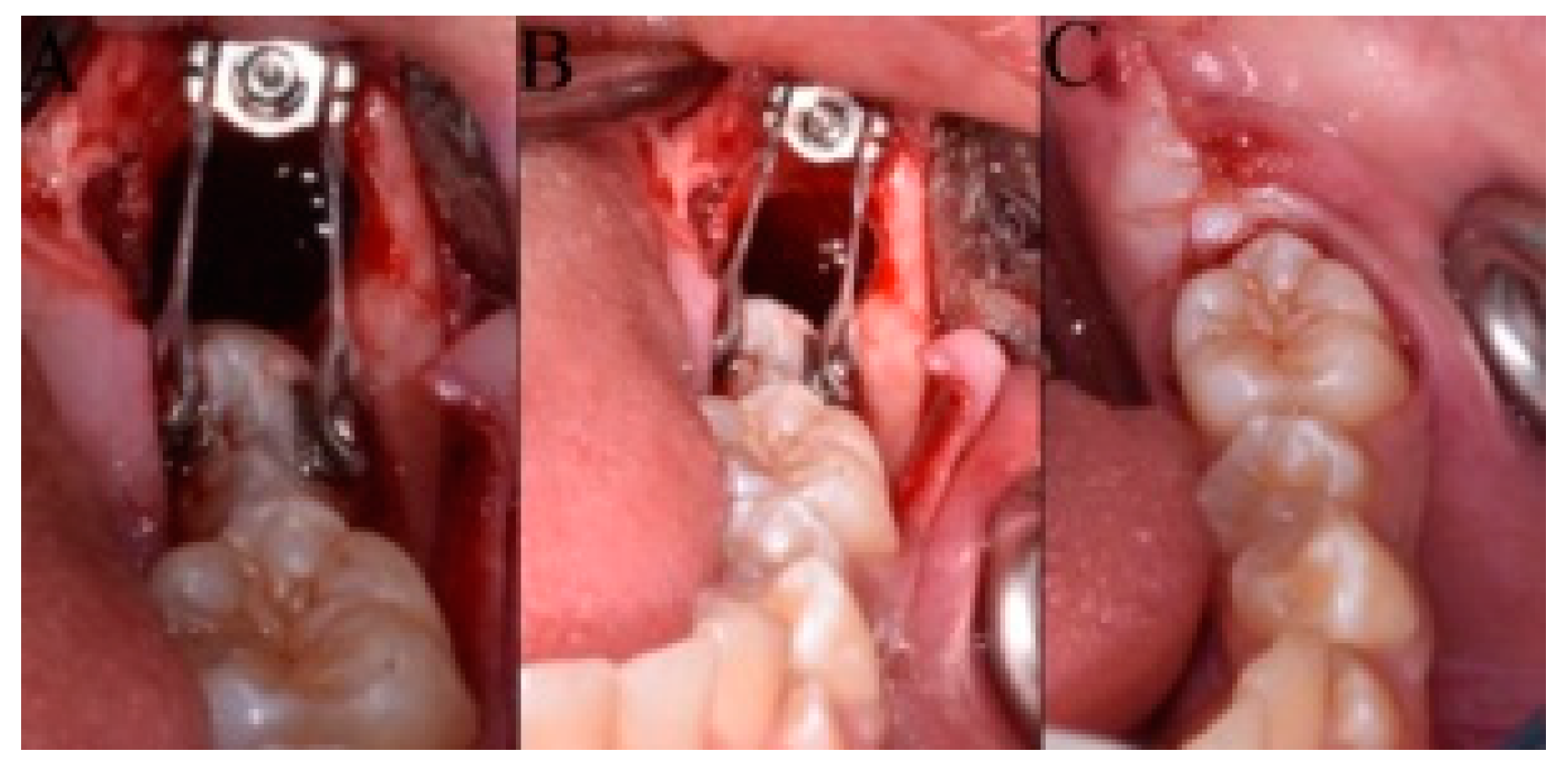 Dentistry 08 00129 g002