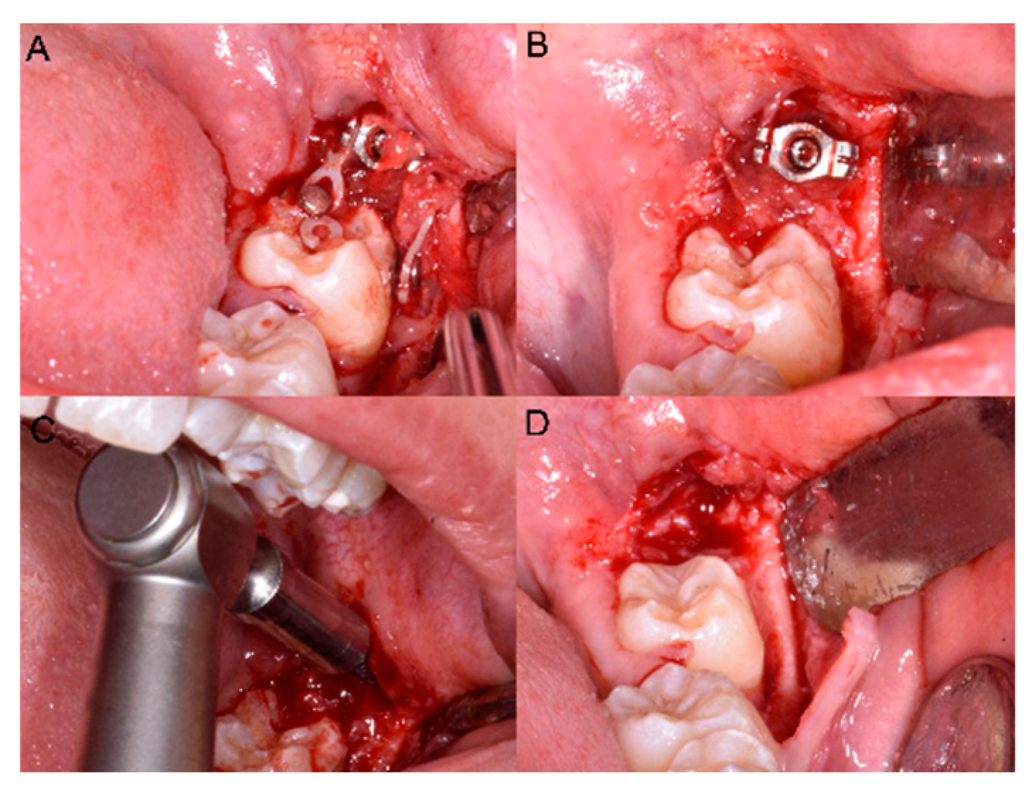 Dentistry 08 00129 g004