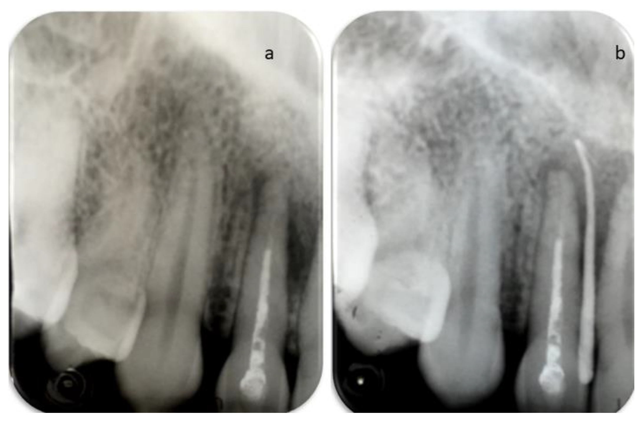Dentistry 09 00027 g002 Dentistry 09 00027 g002