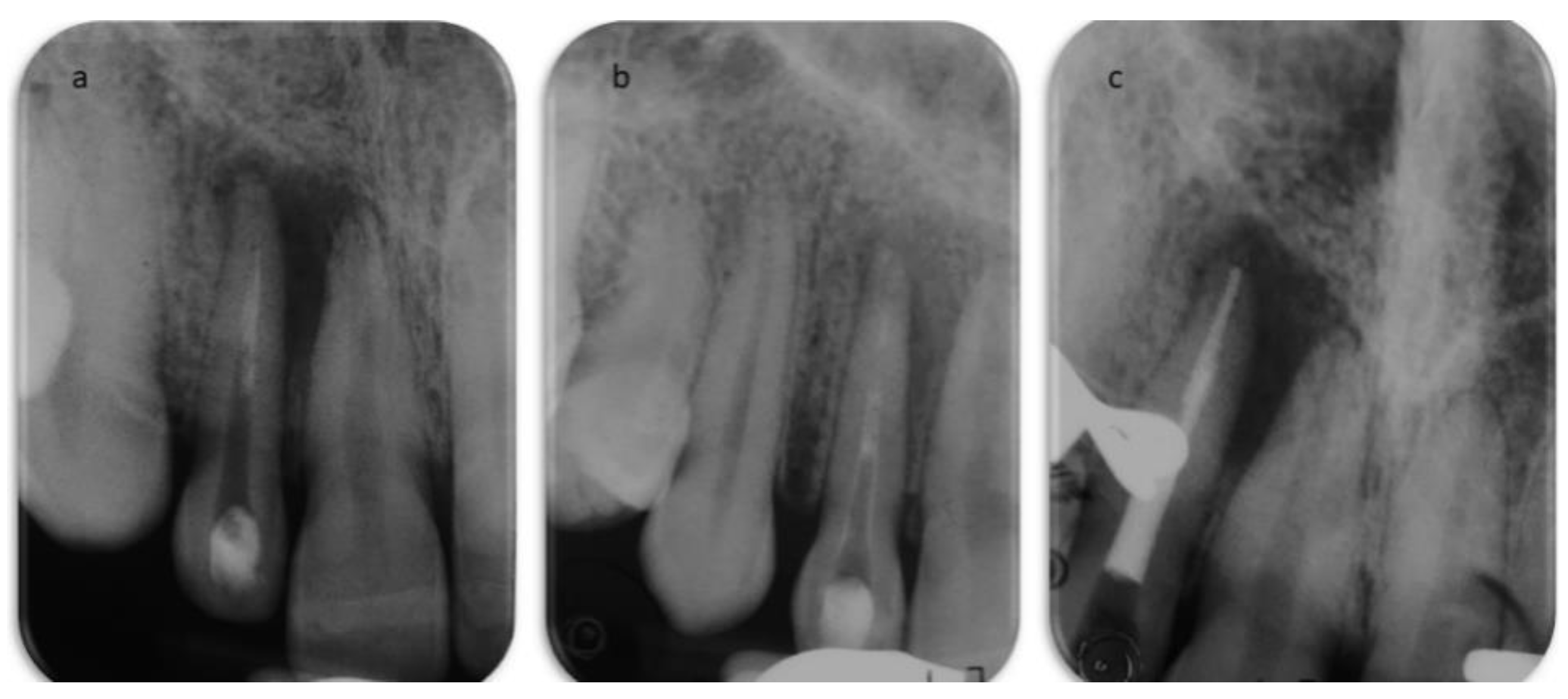 Dentistry 09 00027 g004 Dentistry 09 00027 g004