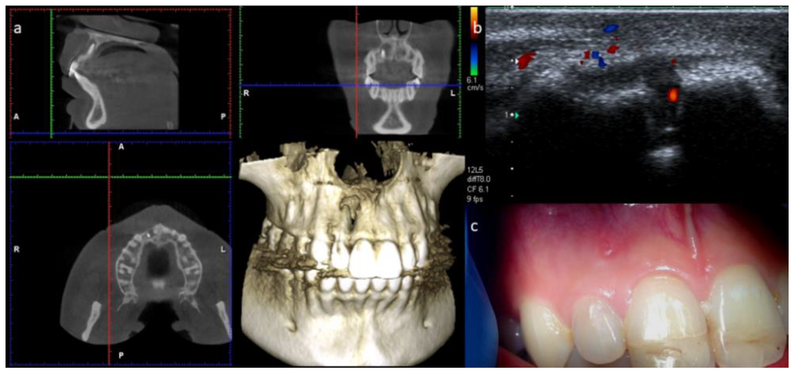 Dentistry 09 00027 g005 Dentistry 09 00027 g005