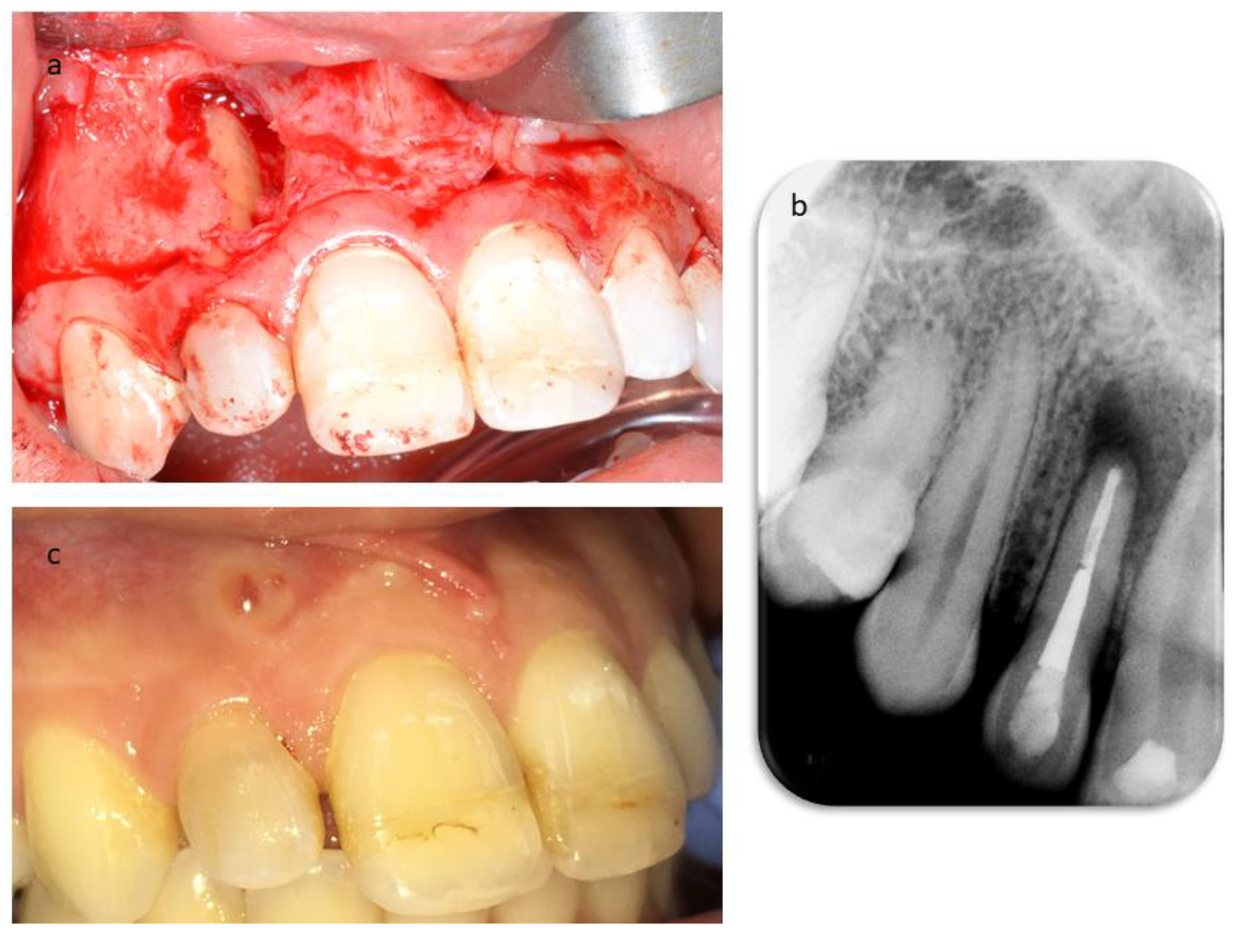 Dentistry 09 00027 g006 Dentistry 09 00027 g006