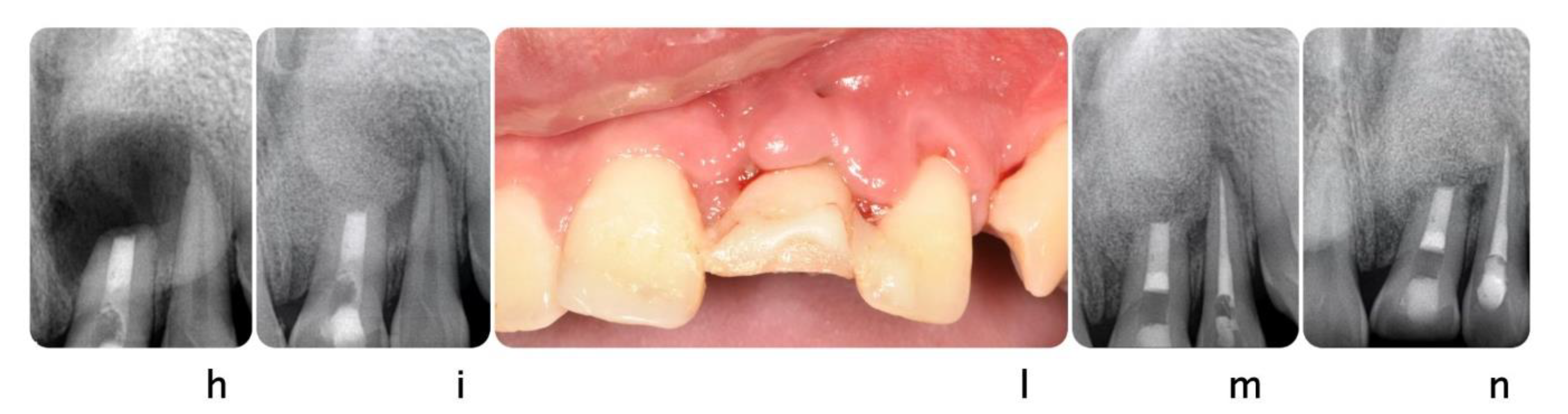 Dentistry 09 00033 g005b Dentistry 09 00033 g005b