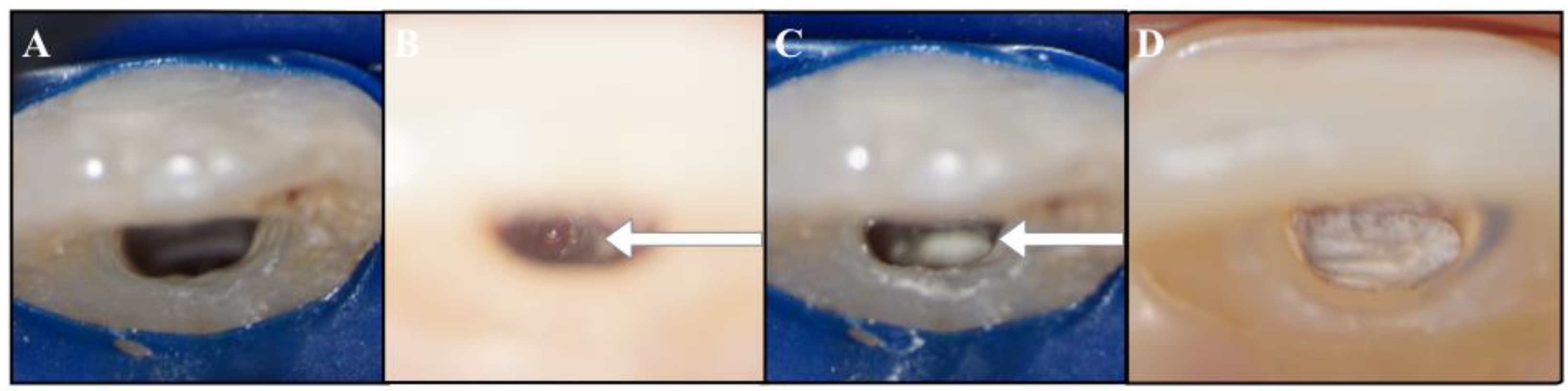 Dentistry 09 00039 g002 Dentistry 09 00039 g002