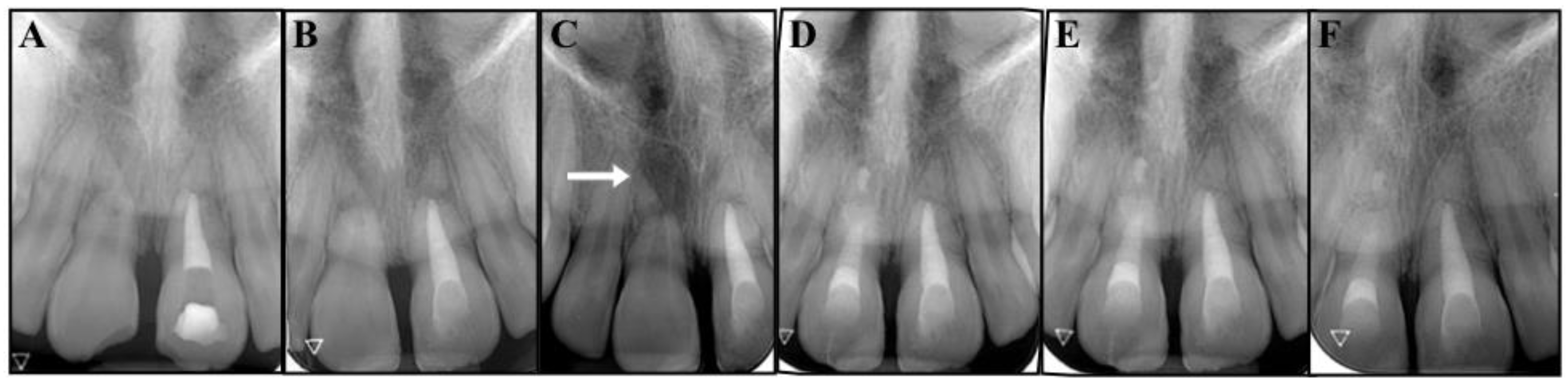 Dentistry 09 00039 g003 Dentistry 09 00039 g003
