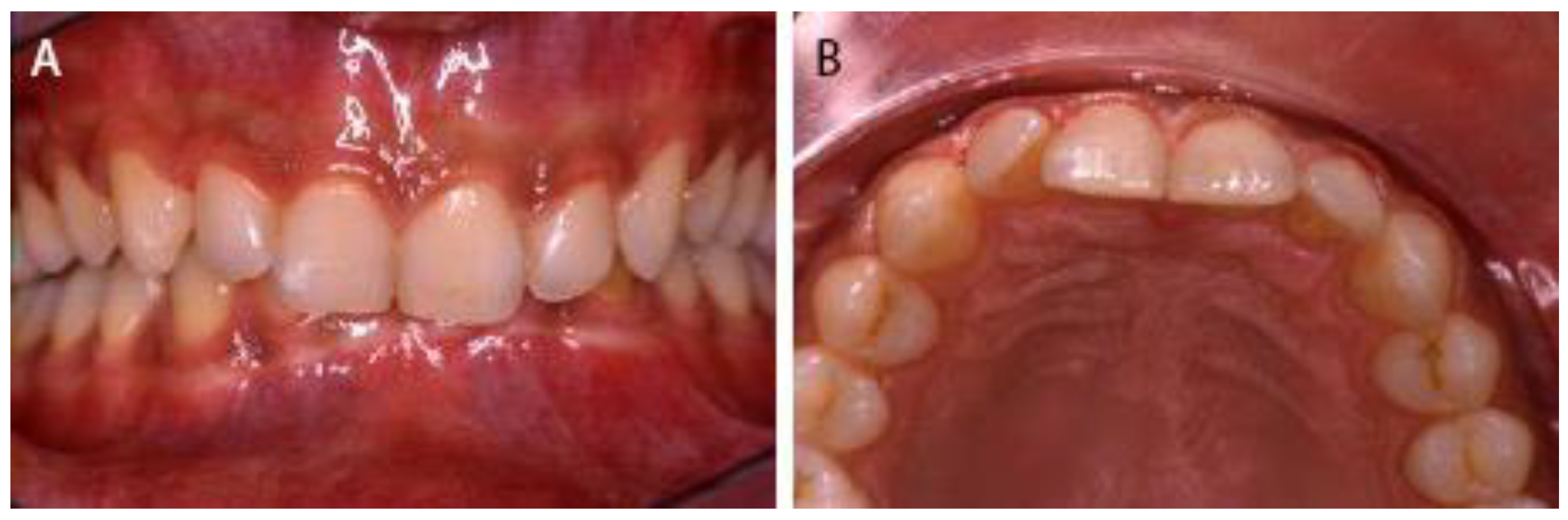 Dentistry 09 00055 g003