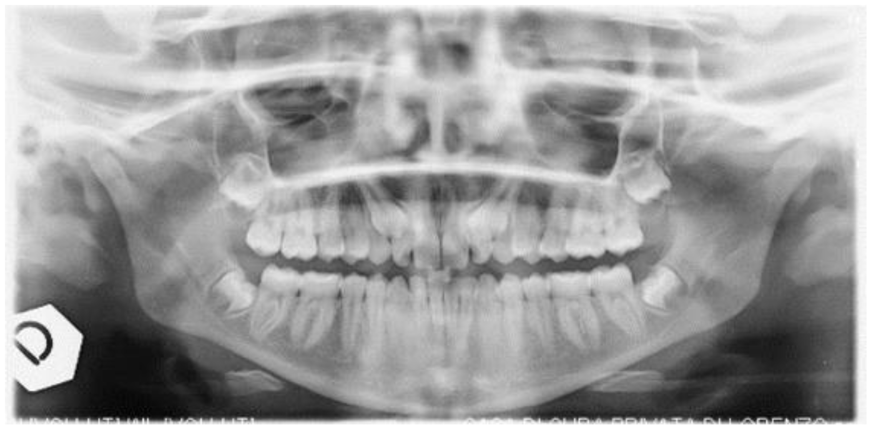 Dentistry 09 00066 g001 Dentistry 09 00066 g001