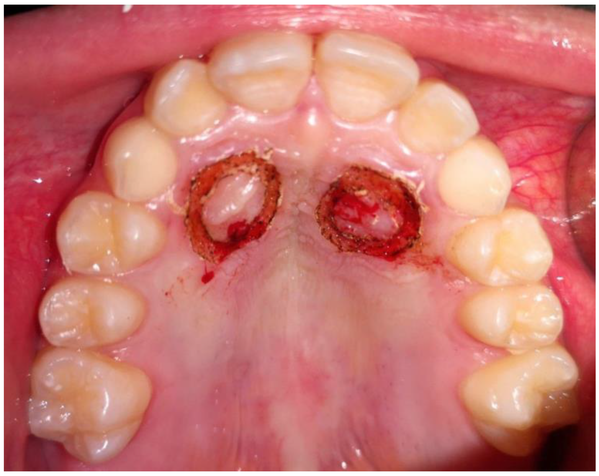 Dentistry 09 00066 g003 Dentistry 09 00066 g003