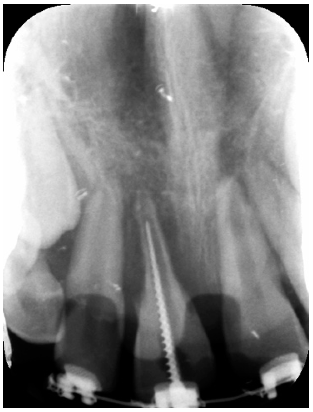 Dentistry 09 00072 g002 Dentistry 09 00072 g002