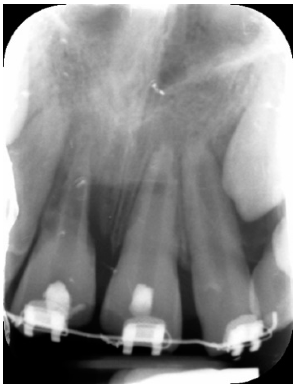 Dentistry 09 00072 g003 Dentistry 09 00072 g003