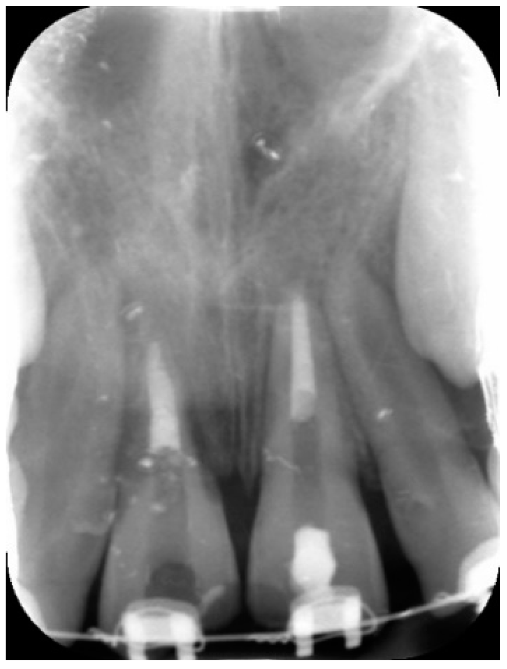 Dentistry 09 00072 g004 Dentistry 09 00072 g004