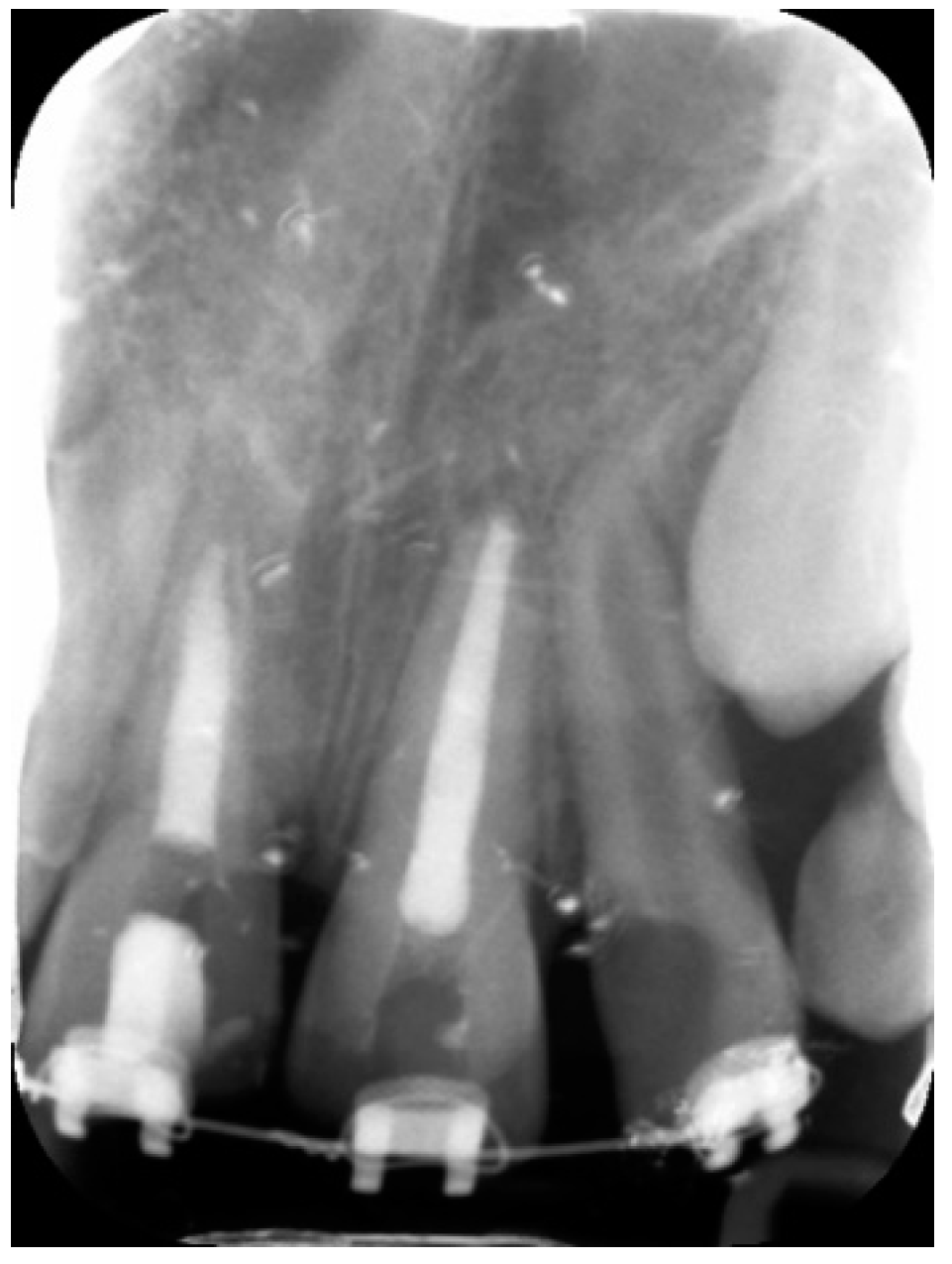 Dentistry 09 00072 g005 Dentistry 09 00072 g005