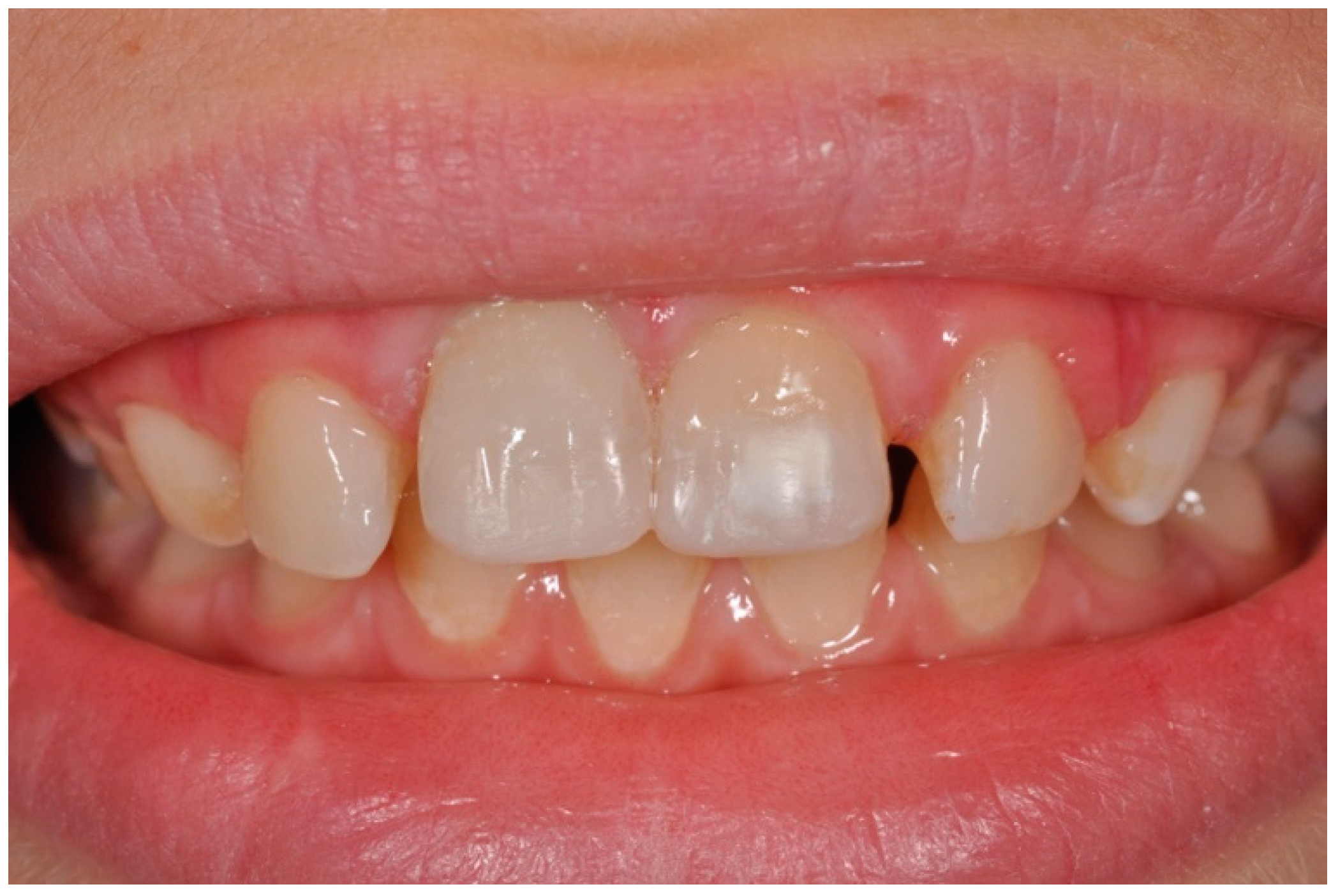 Dentistry 09 00072 g006 Dentistry 09 00072 g006