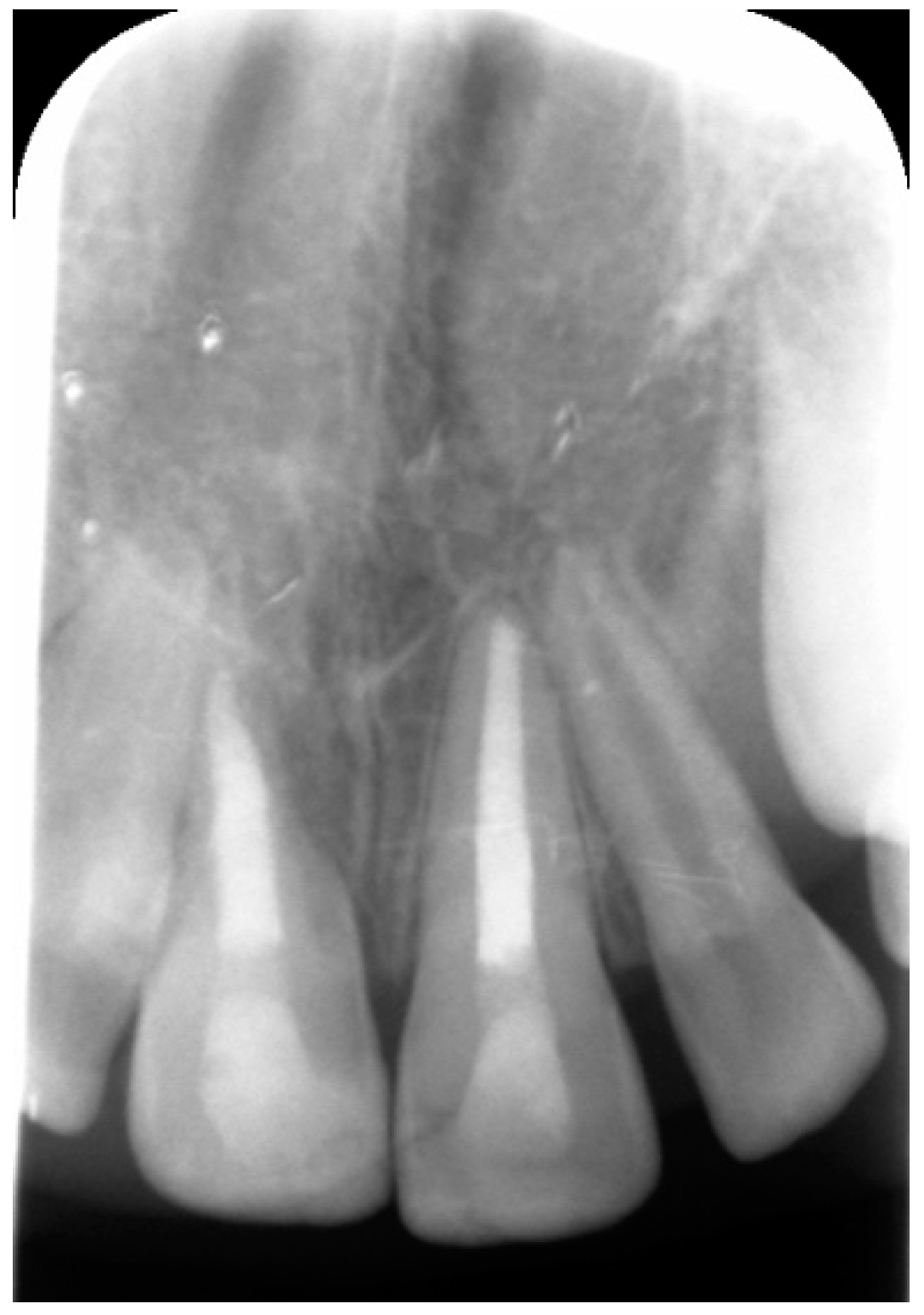 Dentistry 09 00072 g007 Dentistry 09 00072 g007