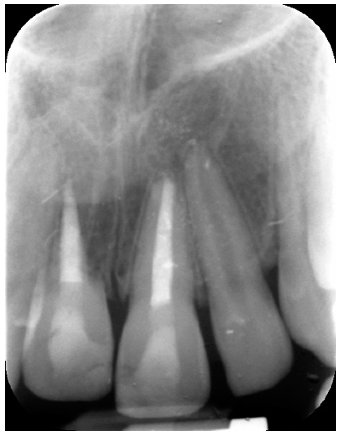 Dentistry 09 00072 g008 Dentistry 09 00072 g008