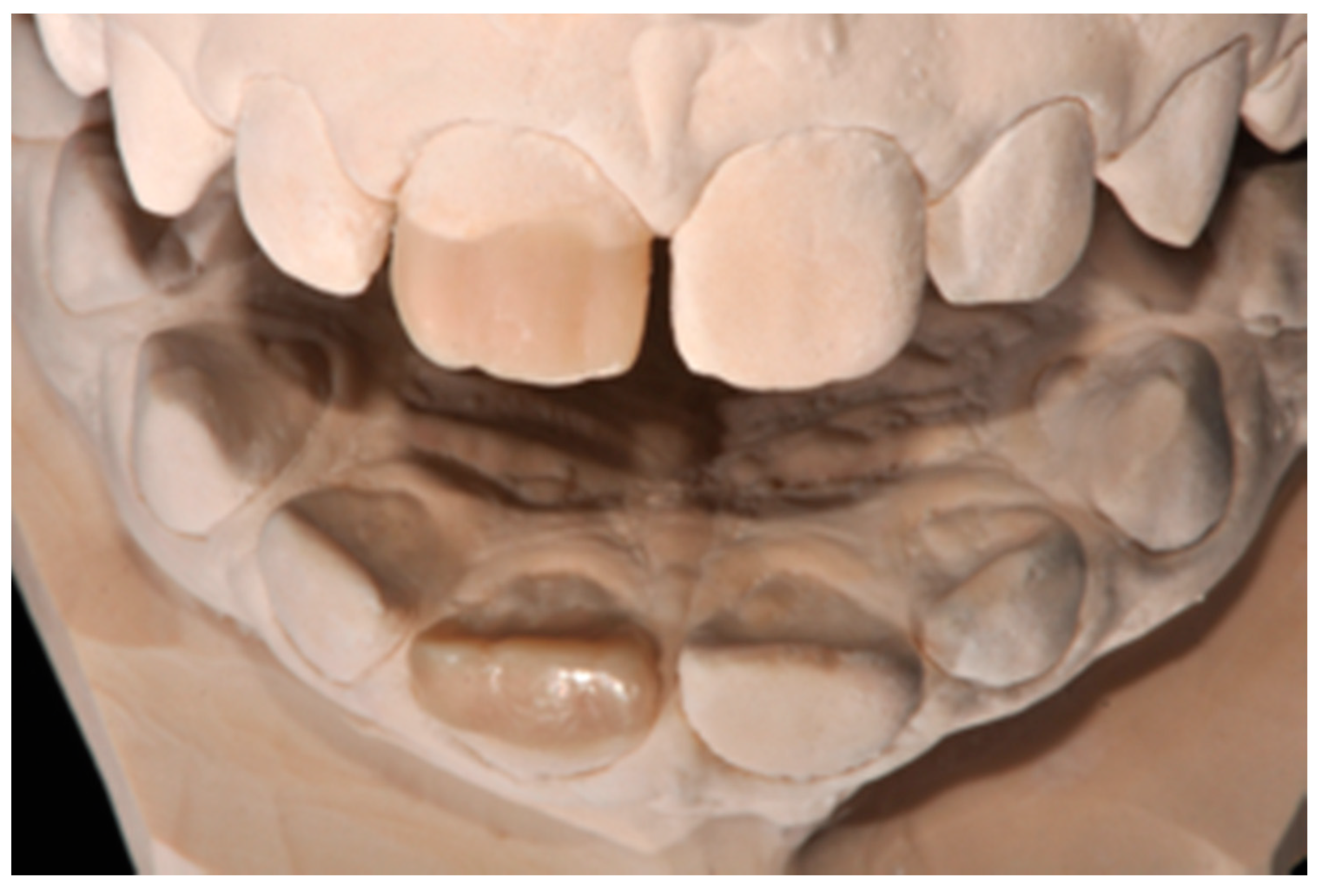 Dentistry 09 00079 g003 550