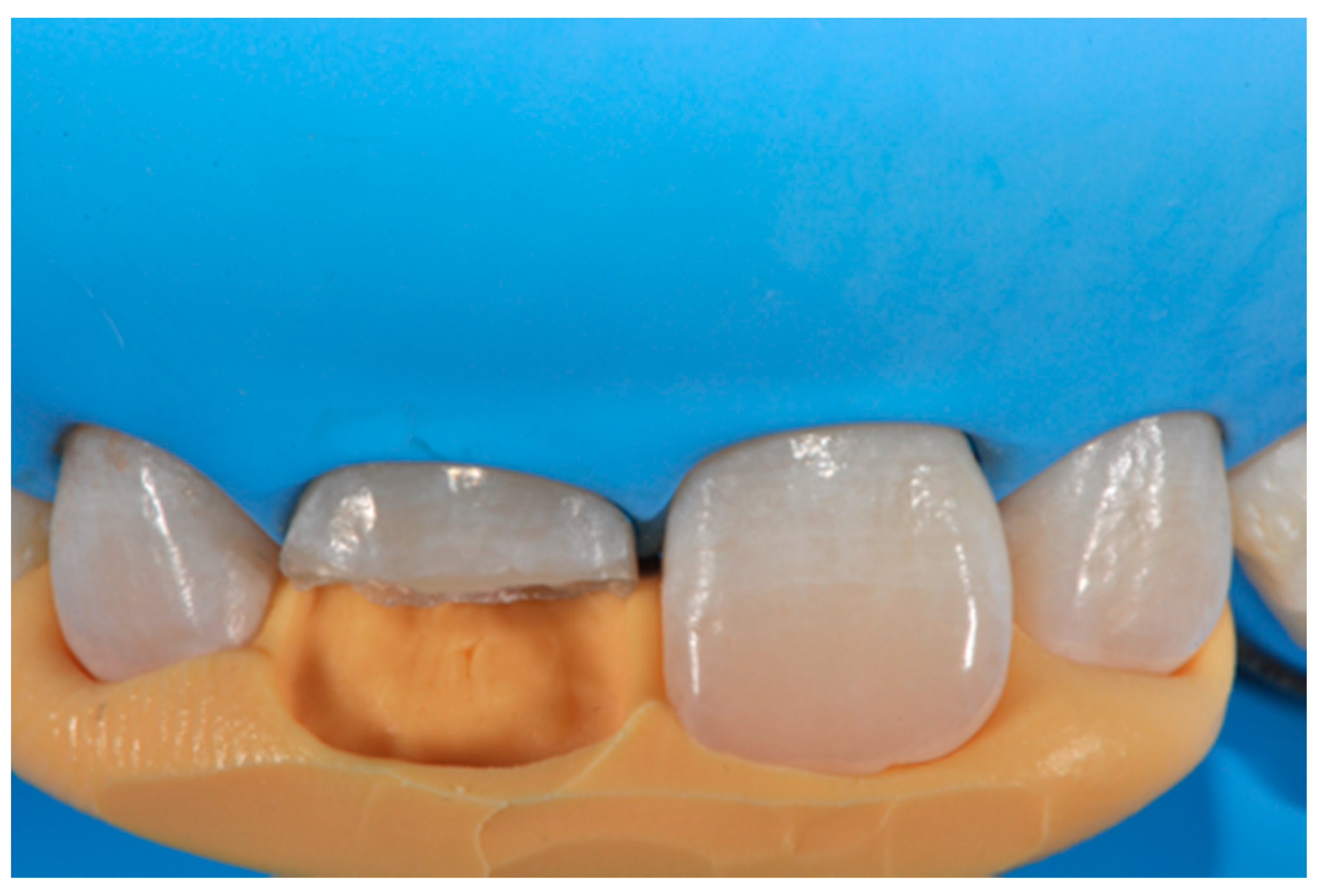 Dentistry 09 00079 g004 550