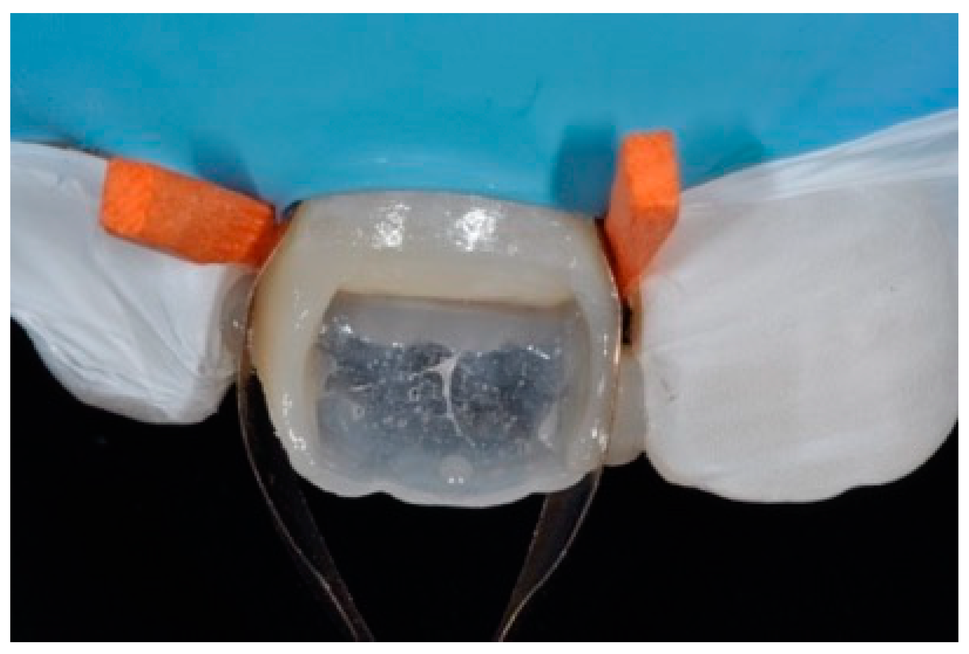 Dentistry 09 00079 g006 550