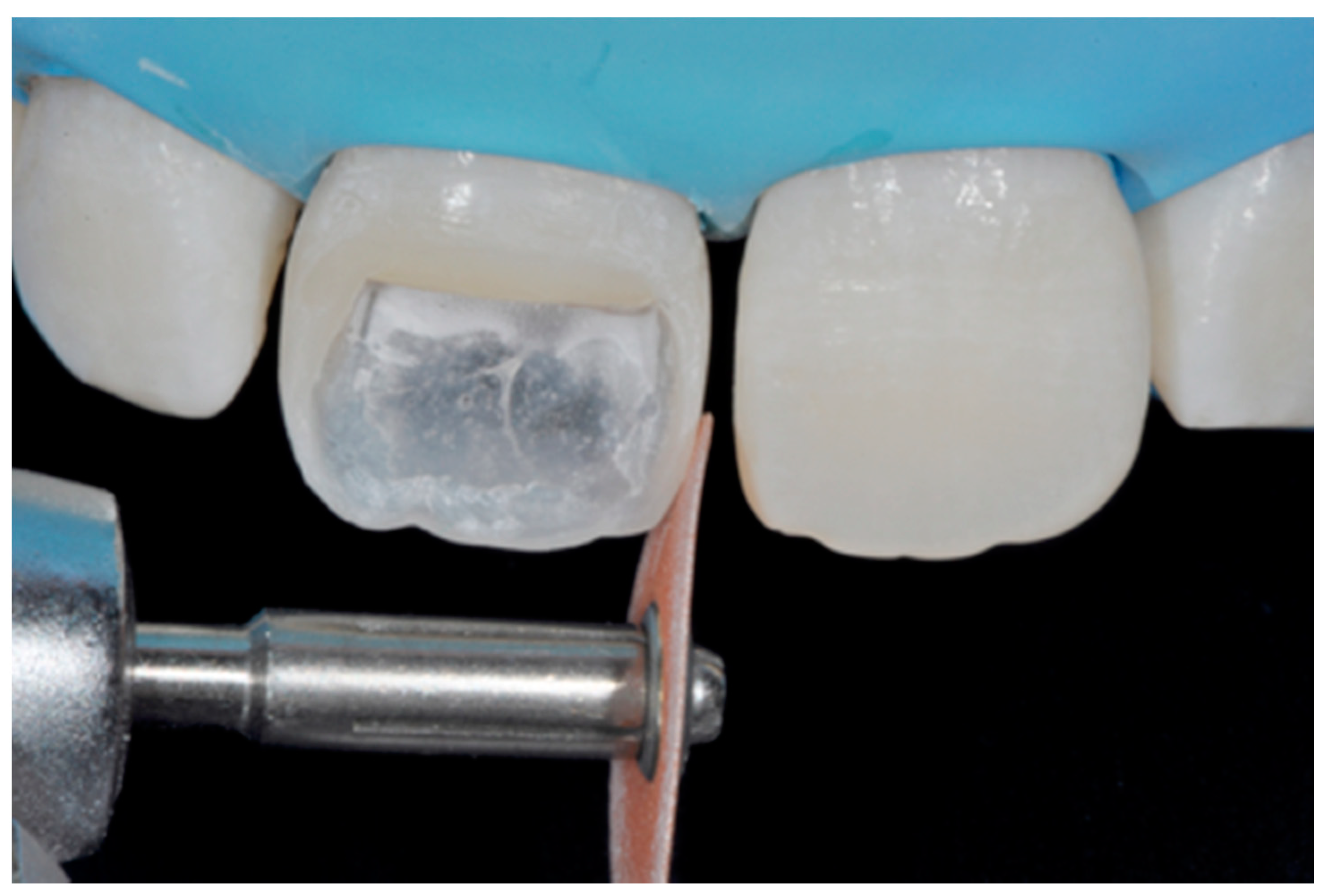 Dentistry 09 00079 g007 550