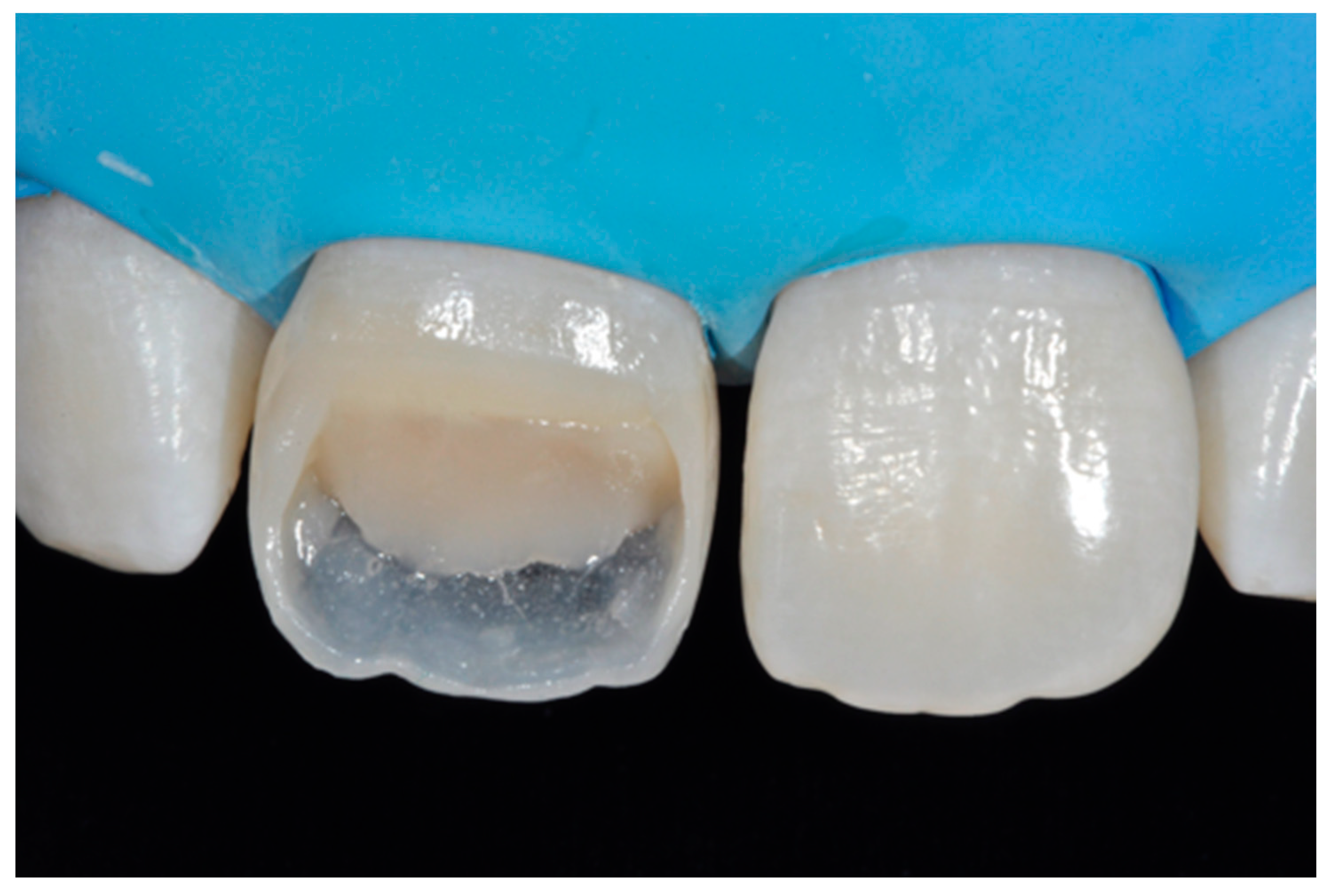 Dentistry 09 00079 g010 550