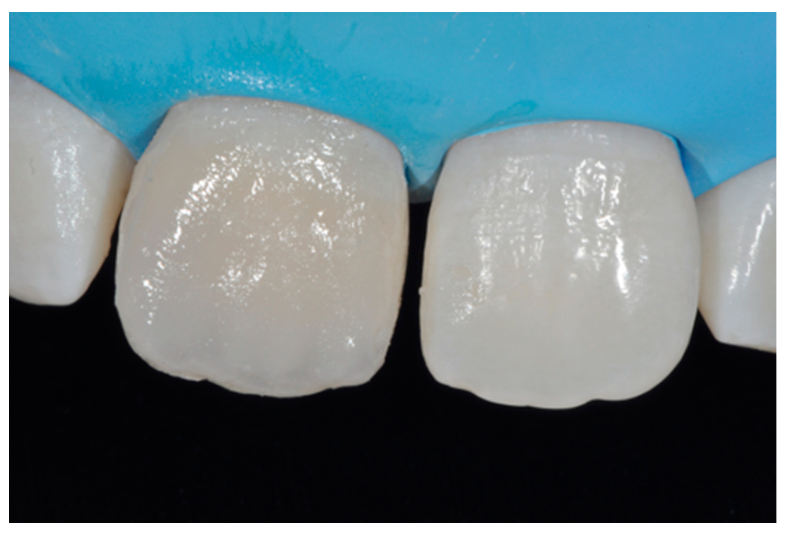 Dentistry 09 00079 g012 550