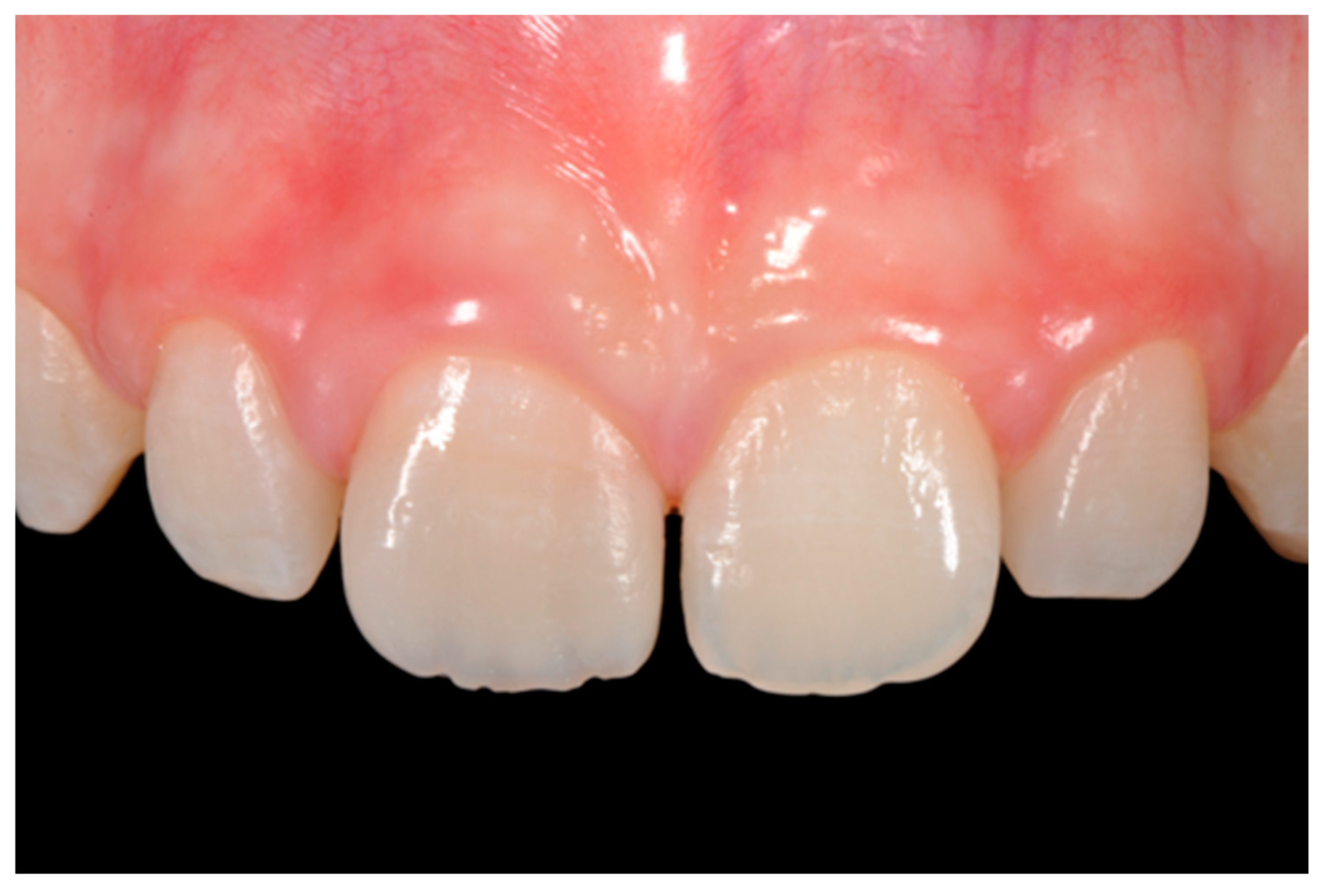 Dentistry 09 00079 g016 550