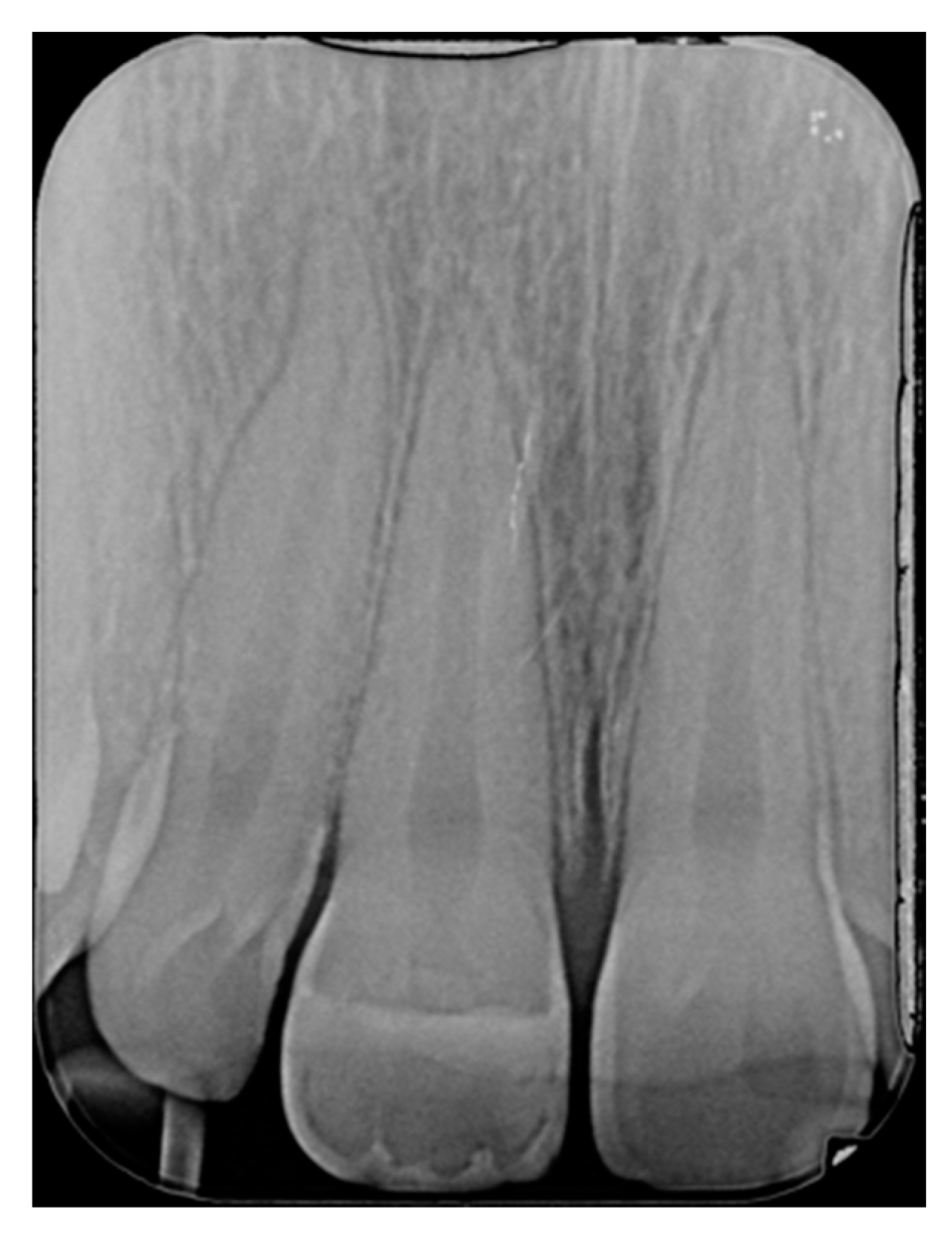 Dentistry 09 00079 g017 550