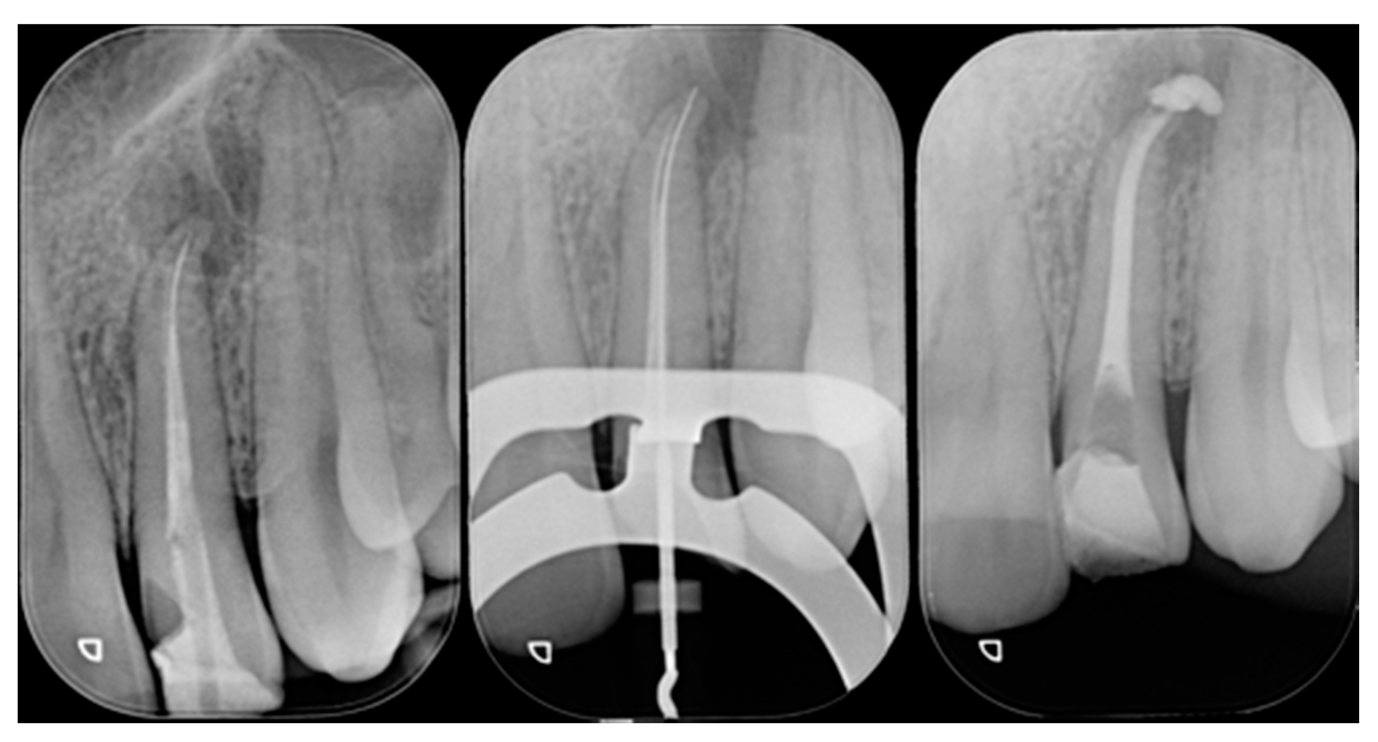 Dentistry 09 00079 g021 550