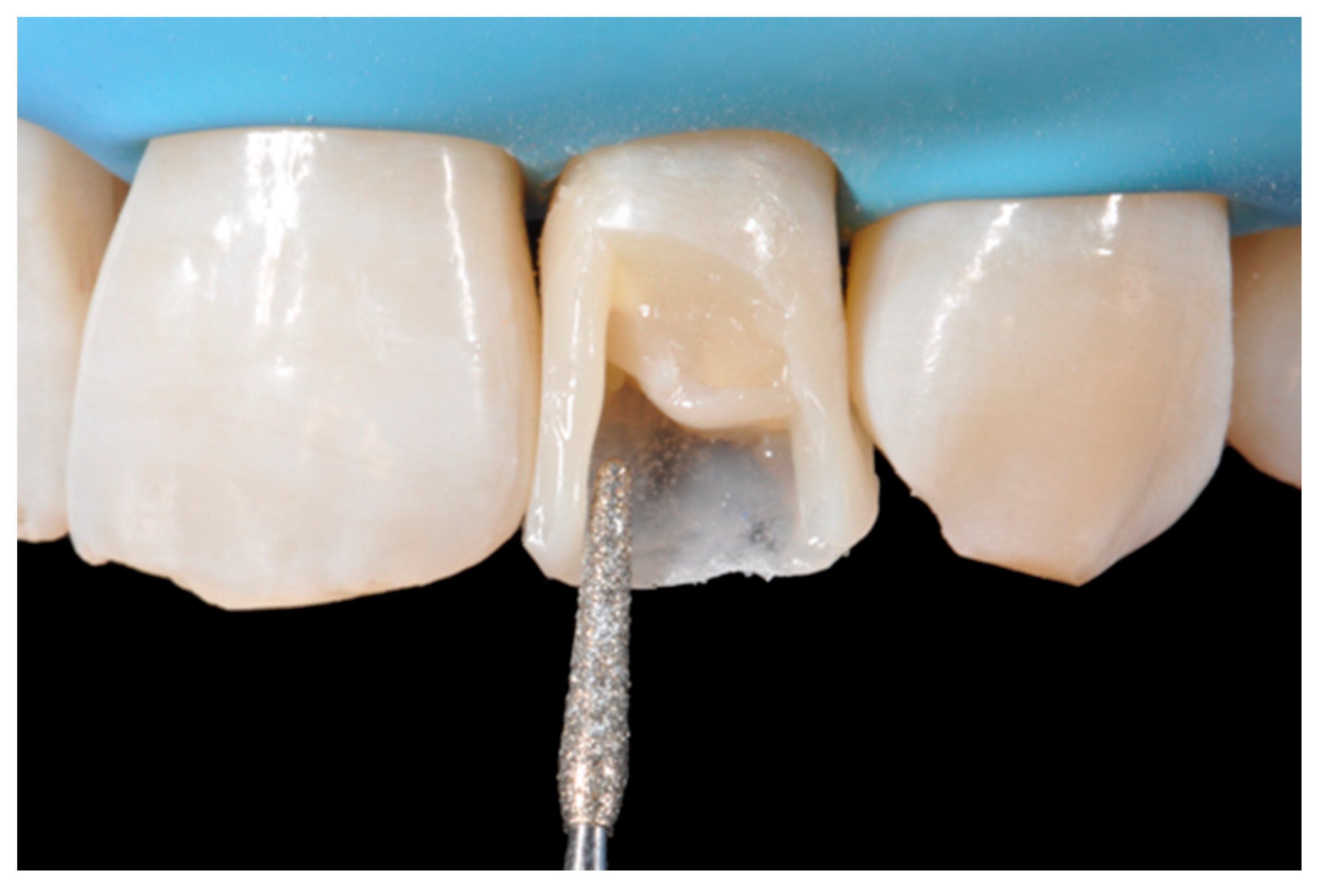 Dentistry 09 00079 g024 550