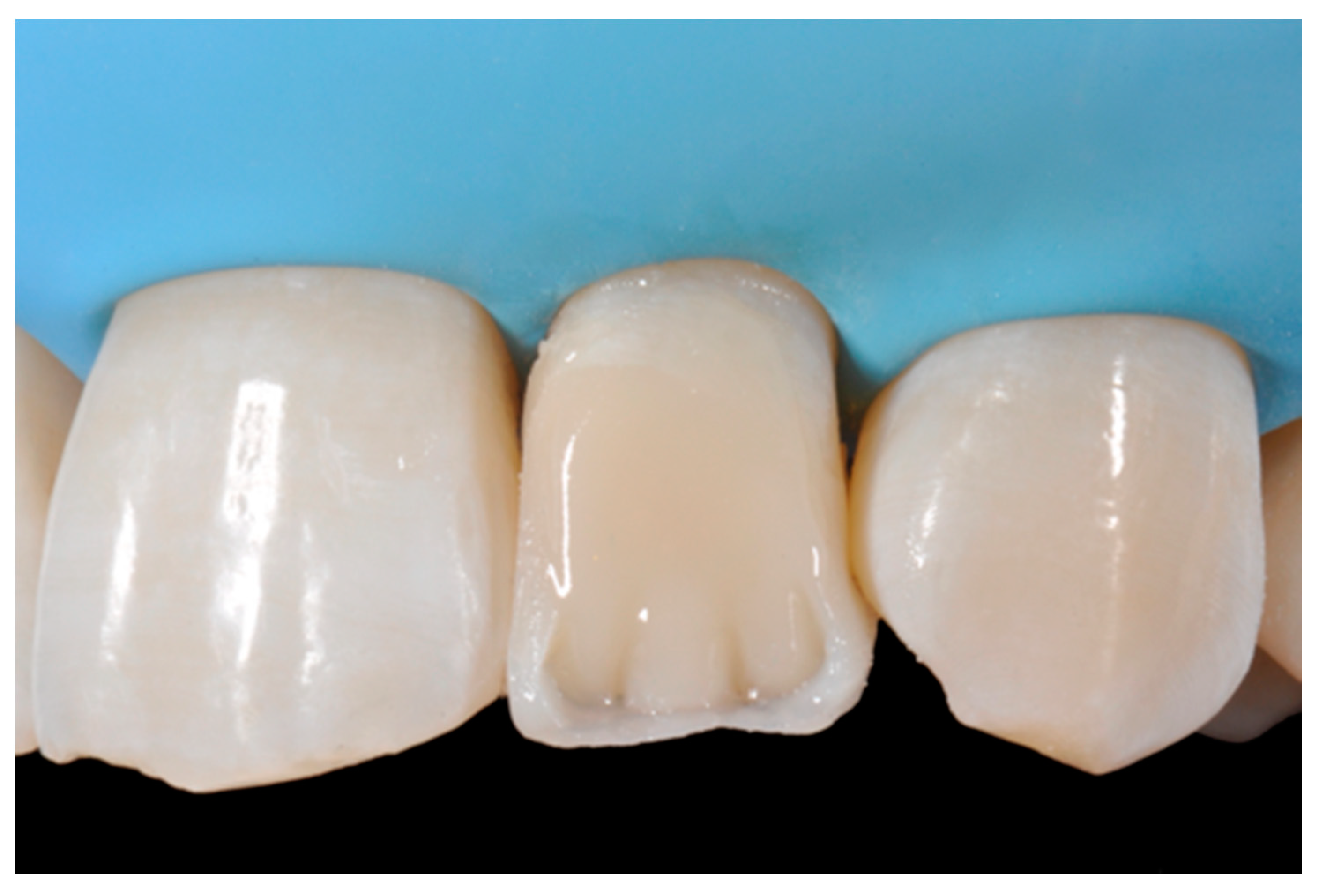 Dentistry 09 00079 g025 550