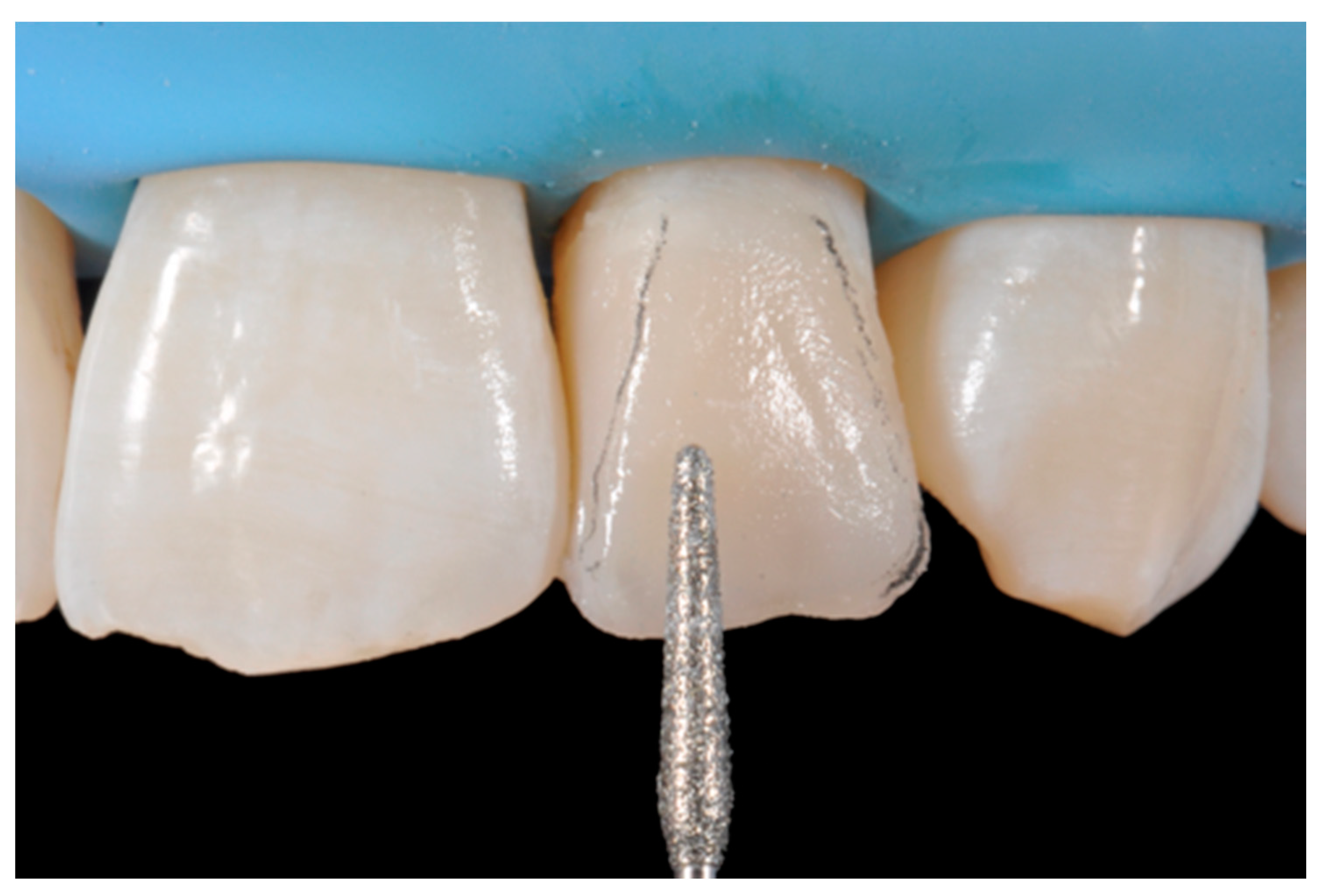 Dentistry 09 00079 g026 550