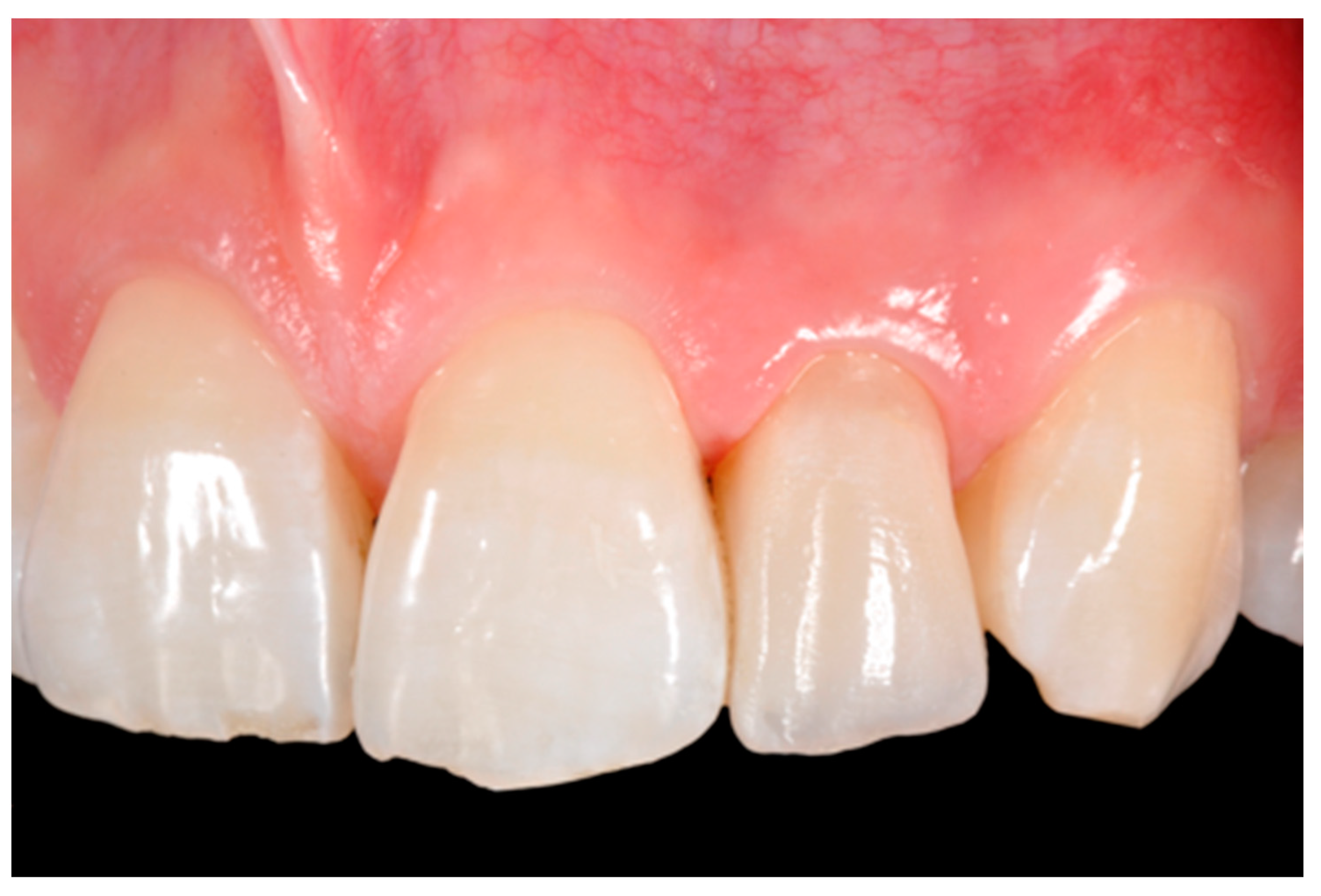 Dentistry 09 00079 g028 550