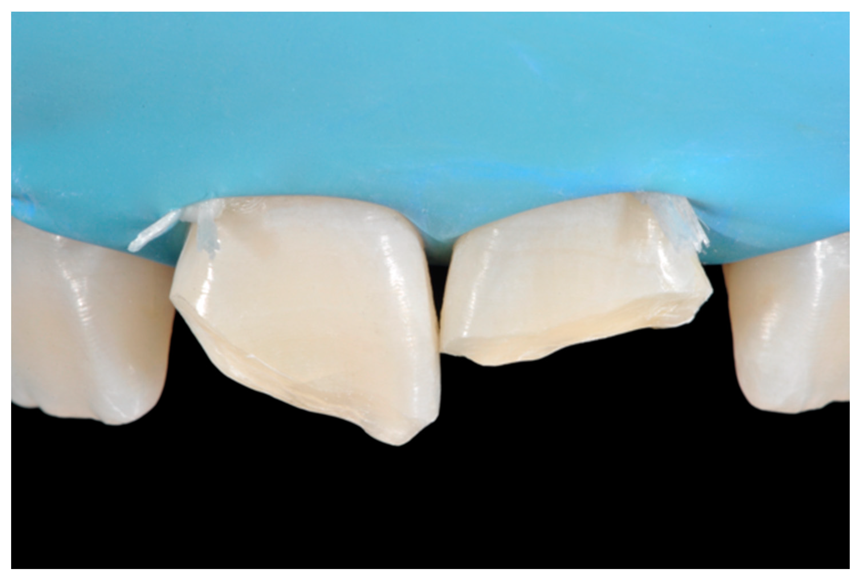 Dentistry 09 00079 g032 550