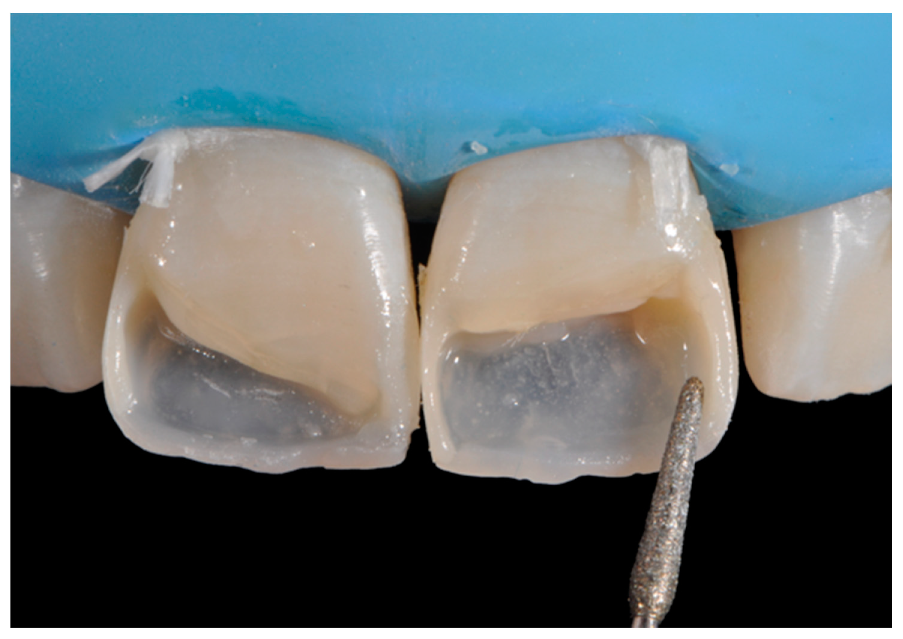 Dentistry 09 00079 g033 550