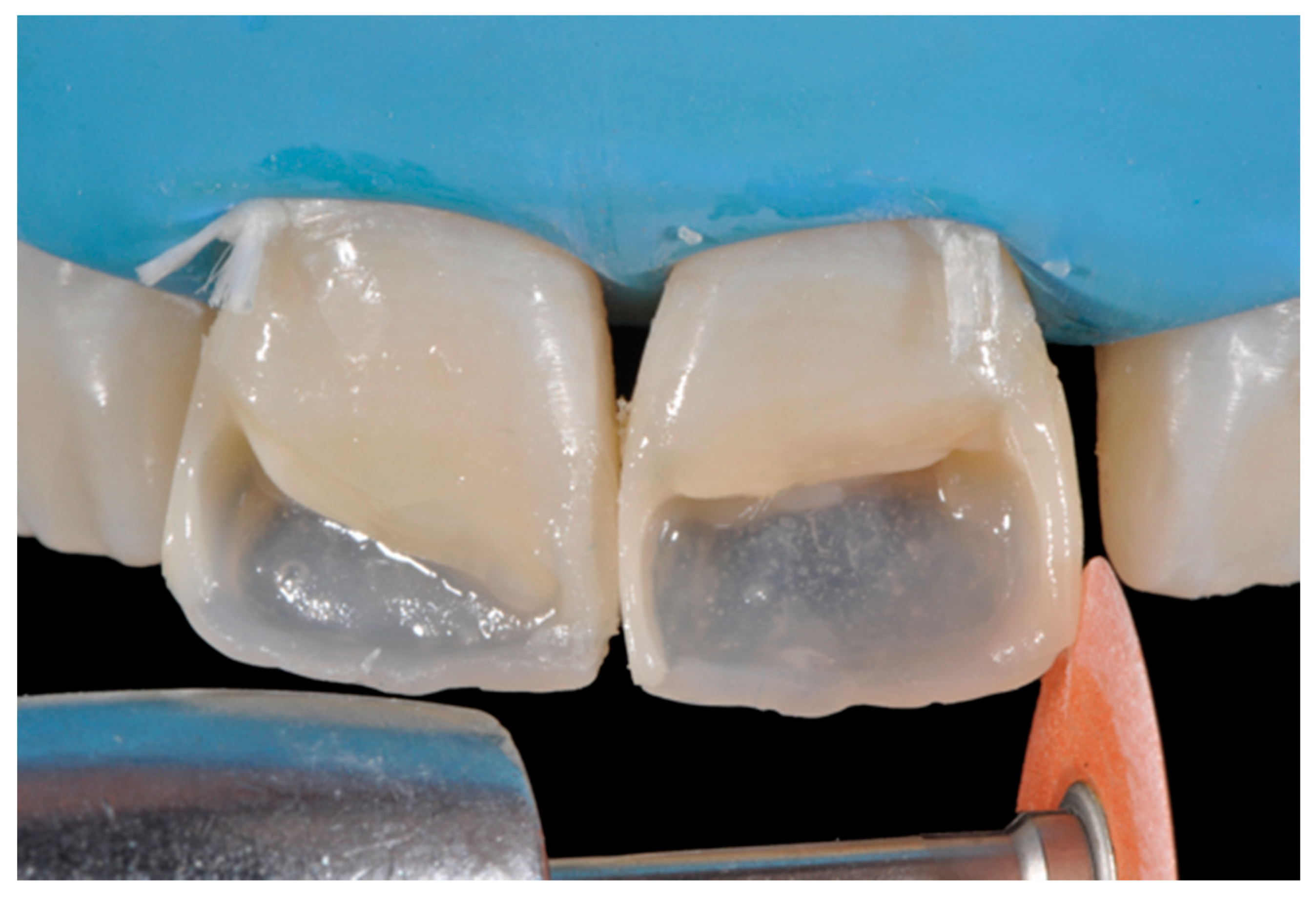 Dentistry 09 00079 g034 550