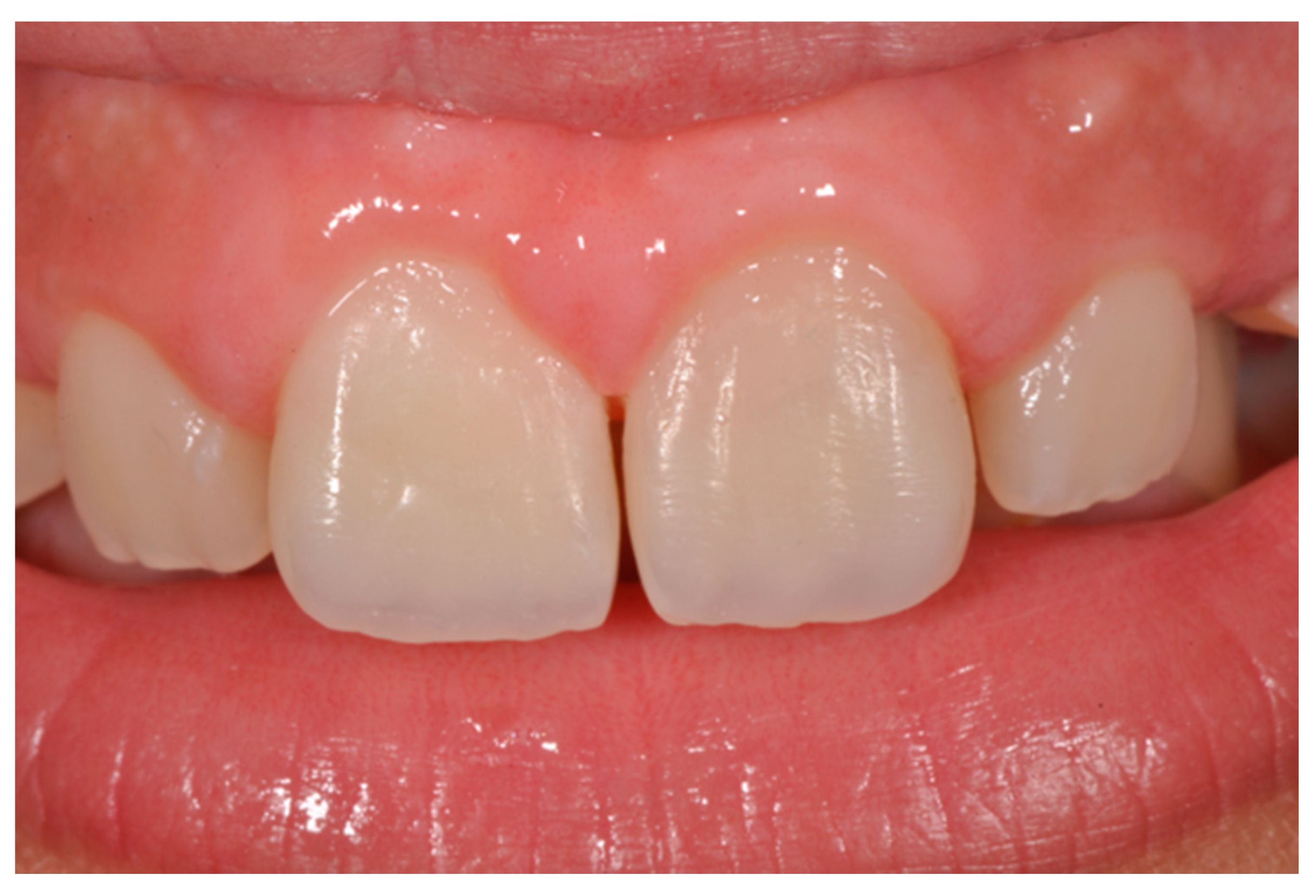 Dentistry 09 00079 g038 550