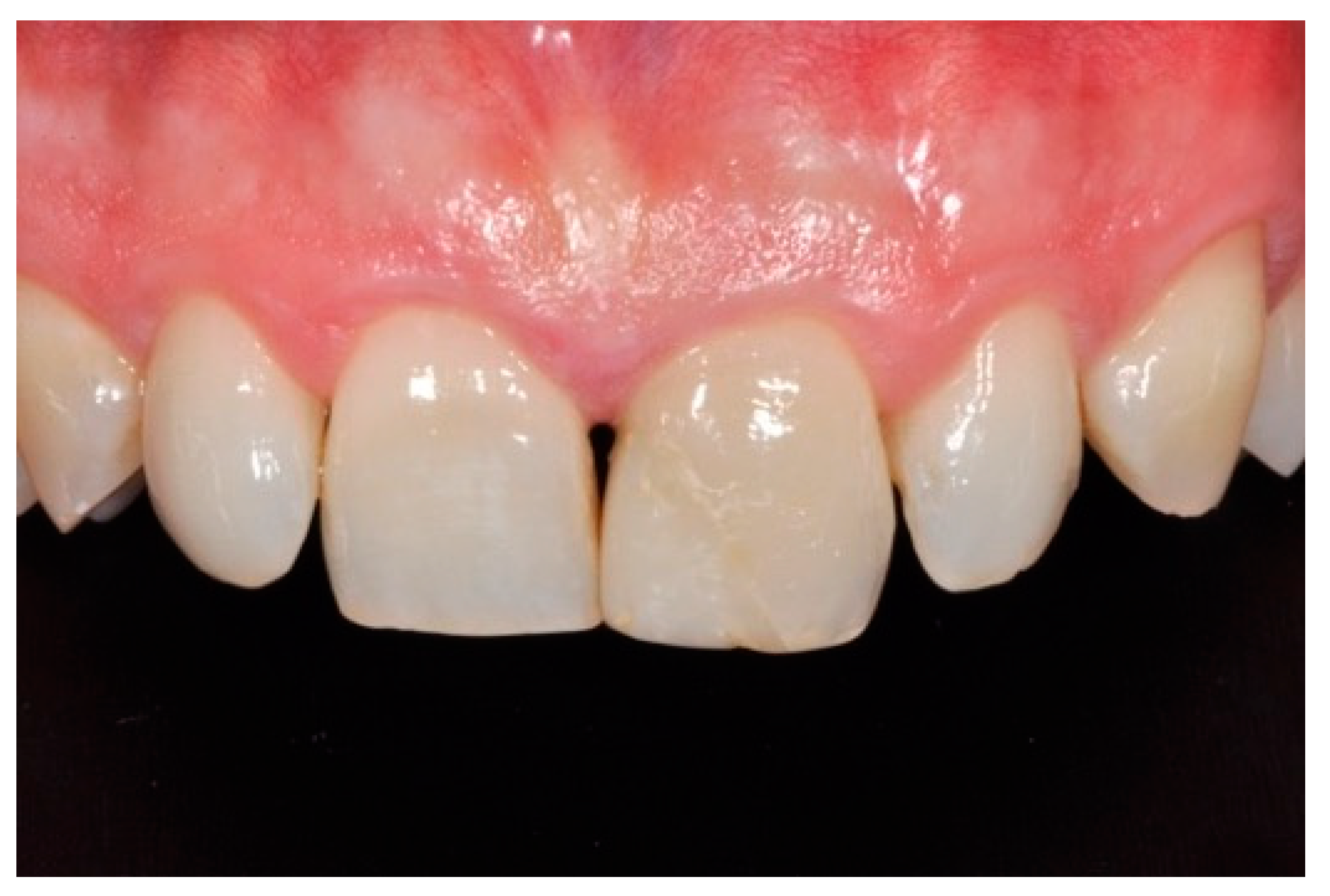 Dentistry 09 00079 g041 550