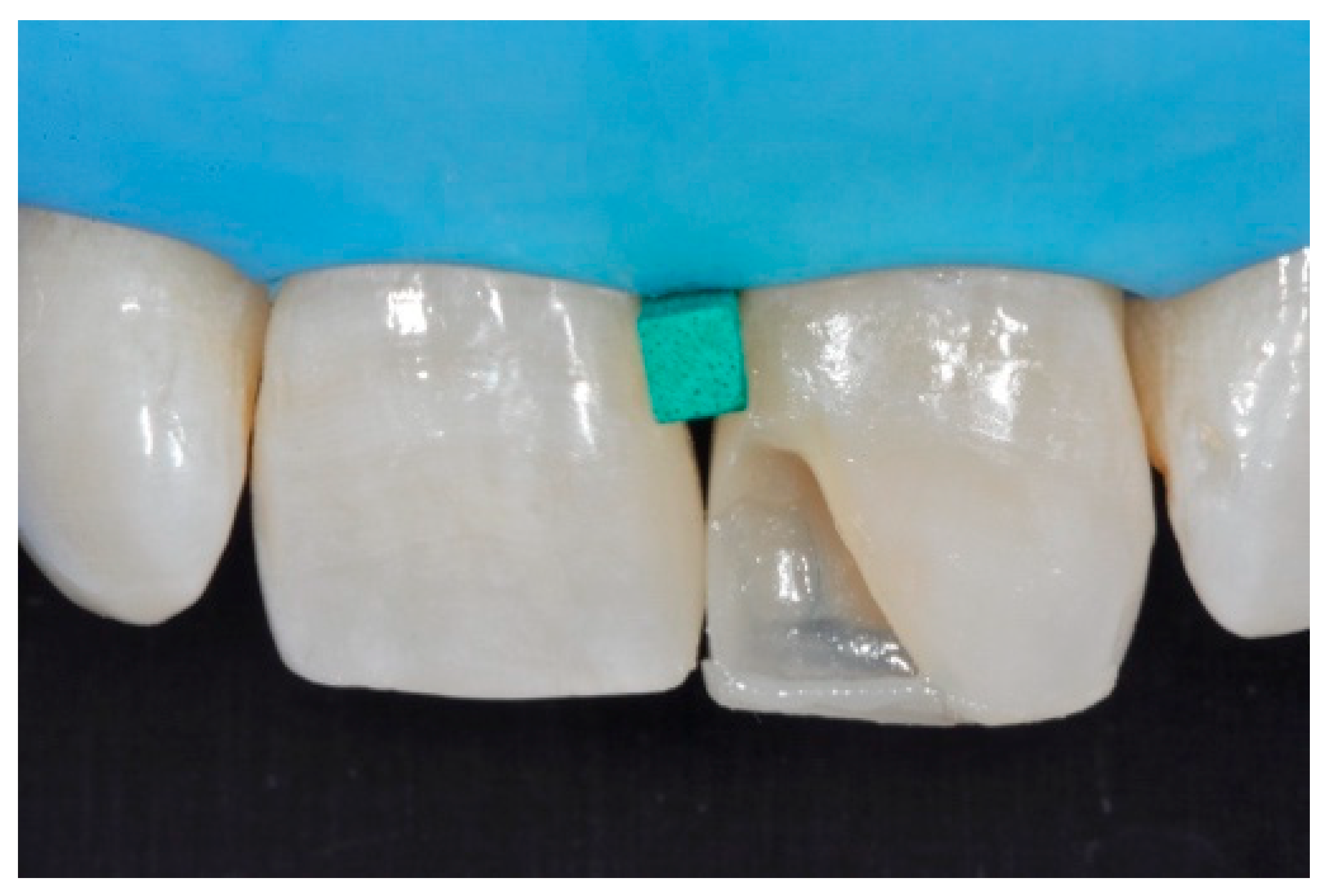 Dentistry 09 00079 g043 550