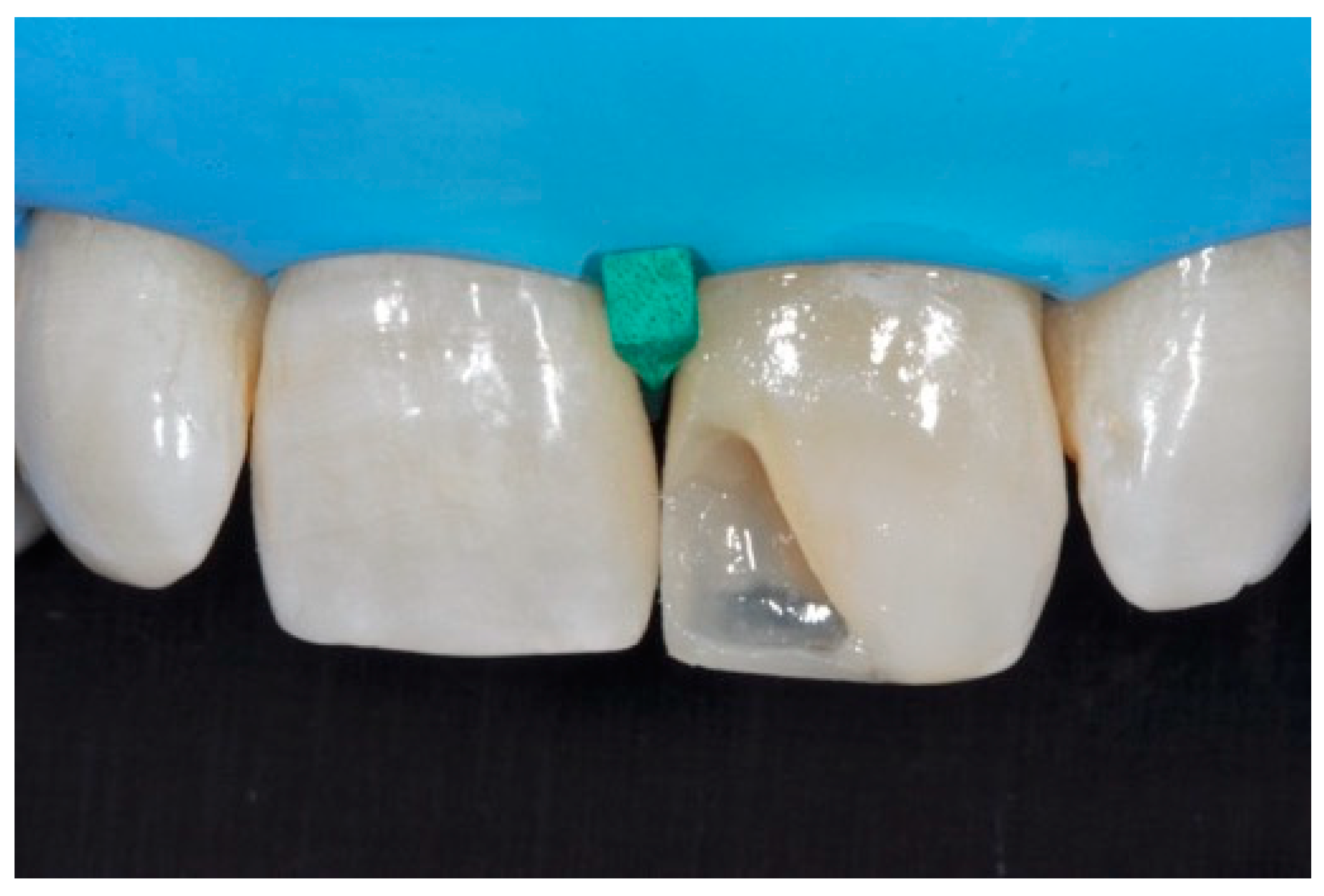 Dentistry 09 00079 g044 550