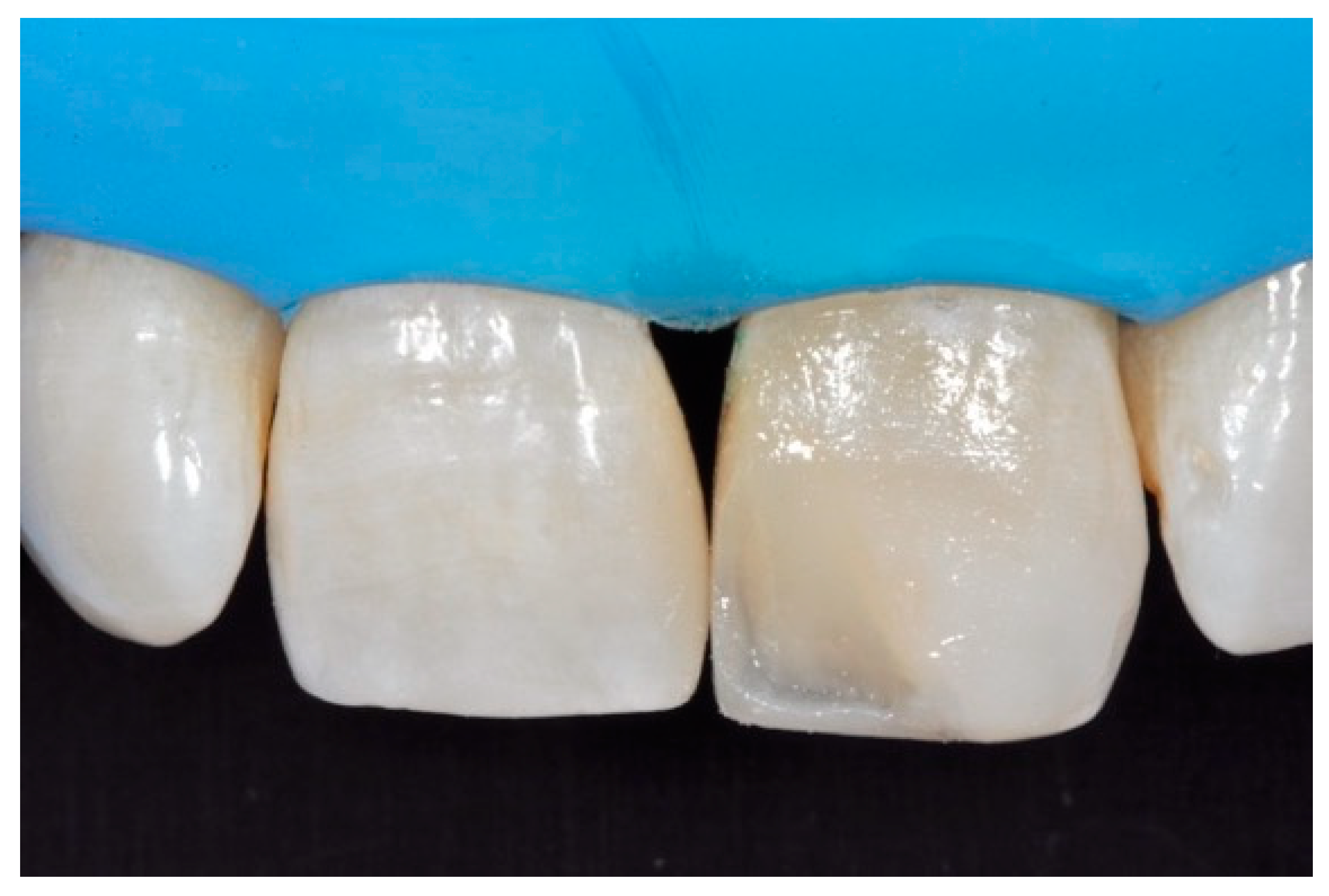 Dentistry 09 00079 g045 550