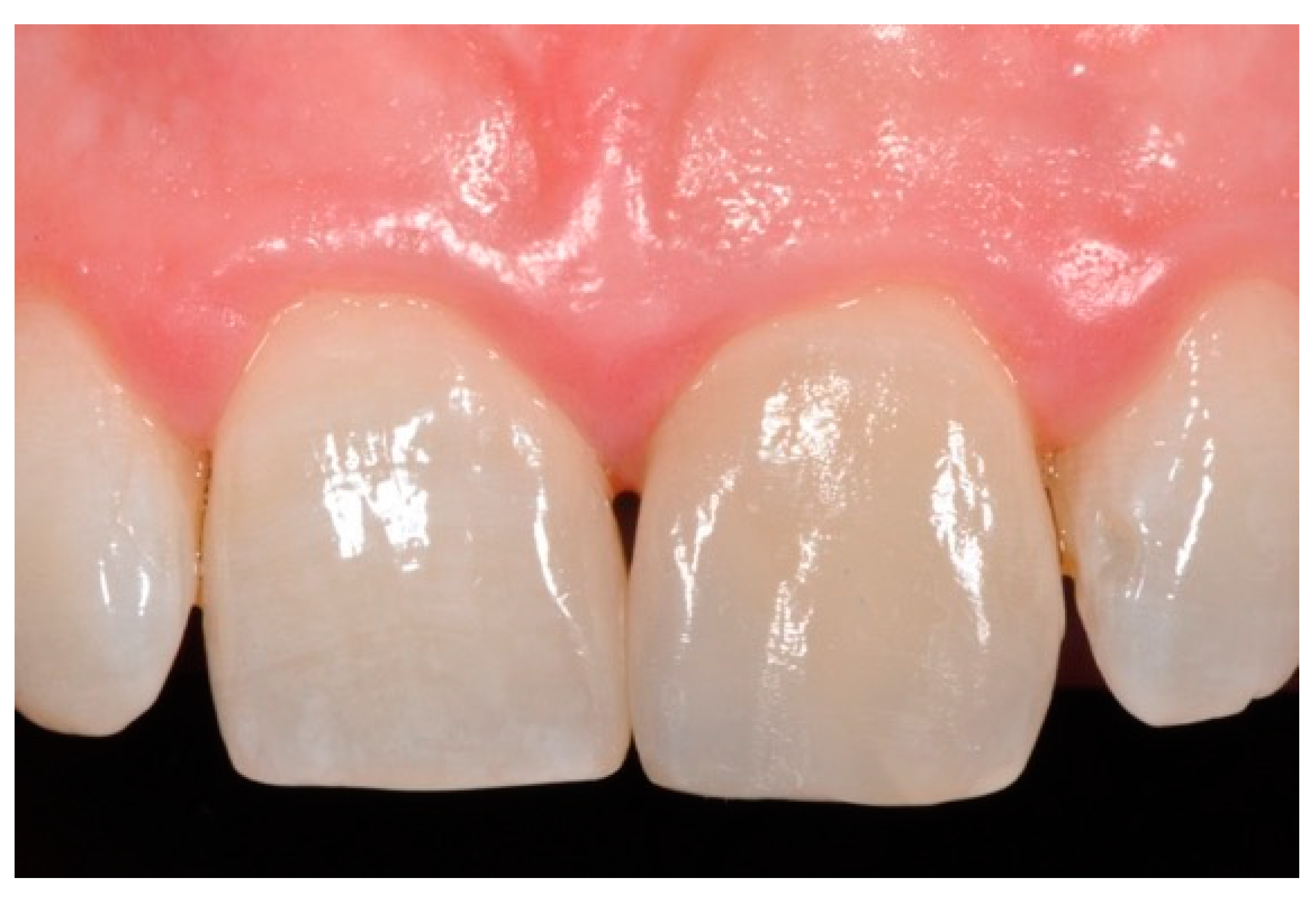 Dentistry 09 00079 g047 550