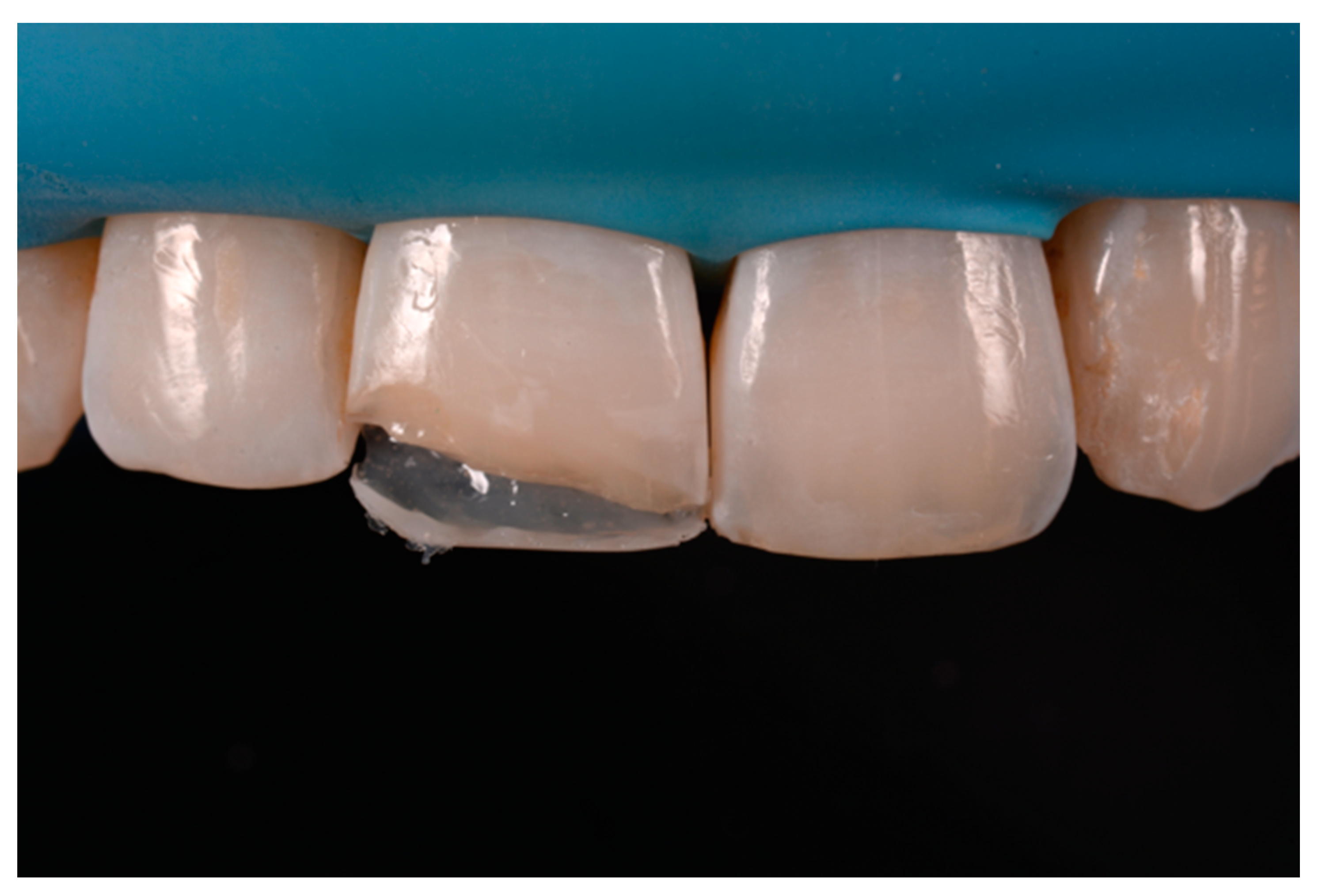 Dentistry 09 00079 g050 550