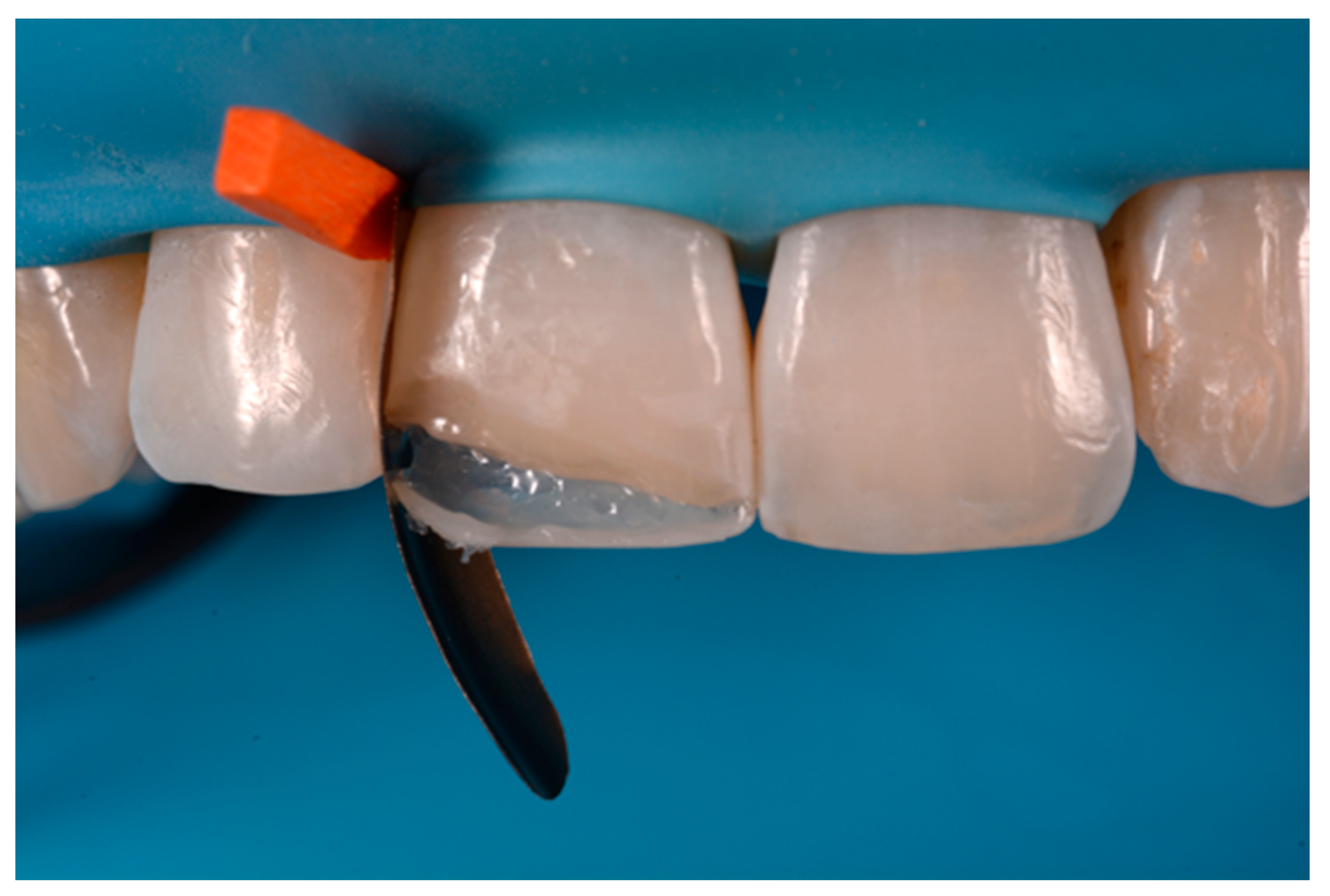 Dentistry 09 00079 g051 550