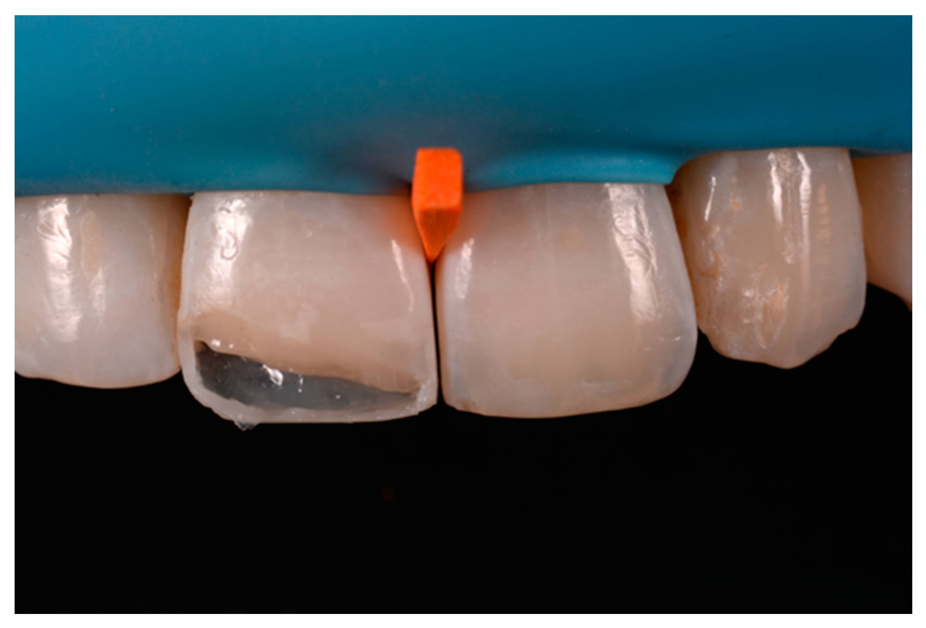 Dentistry 09 00079 g052 550