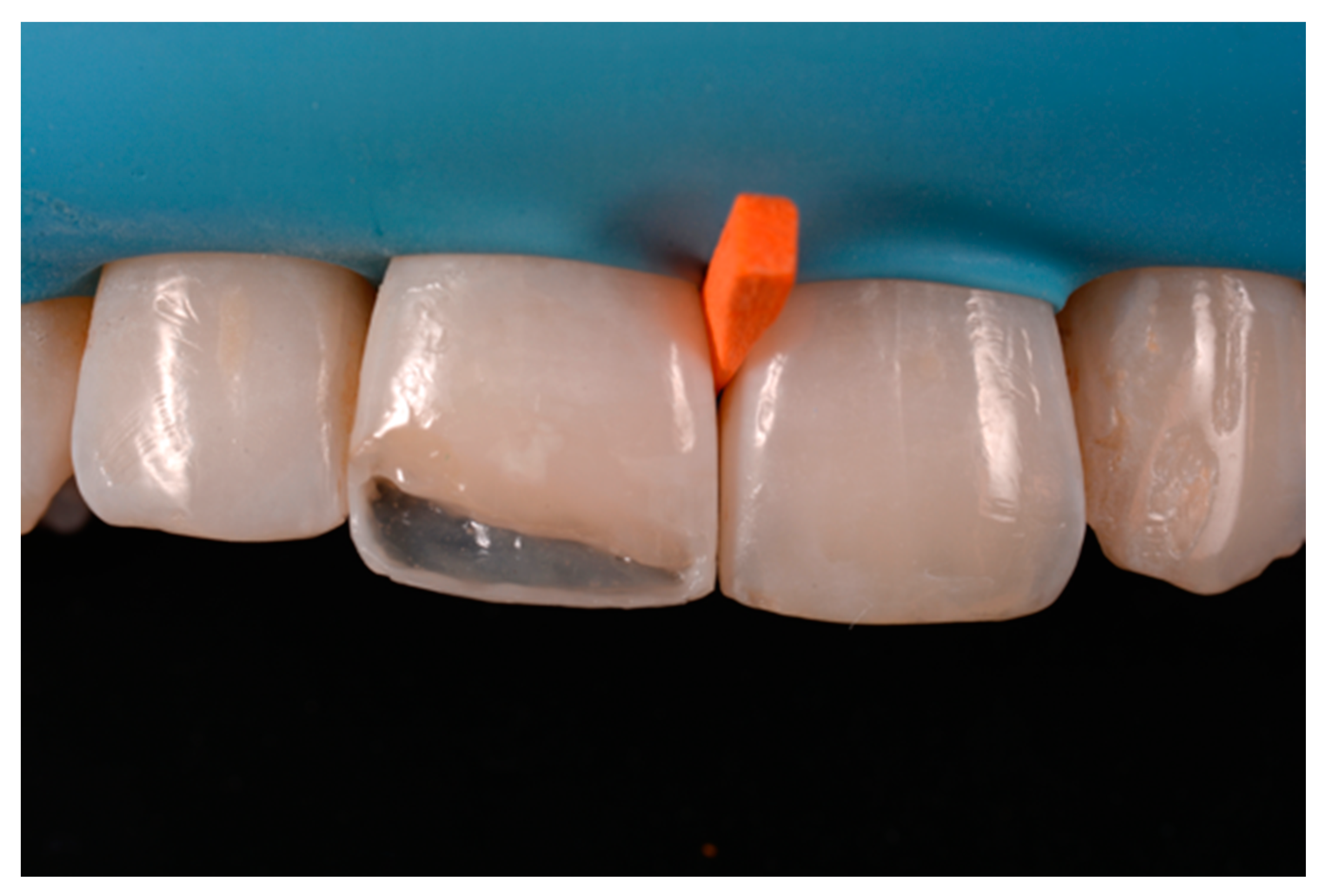 Dentistry 09 00079 g053 550