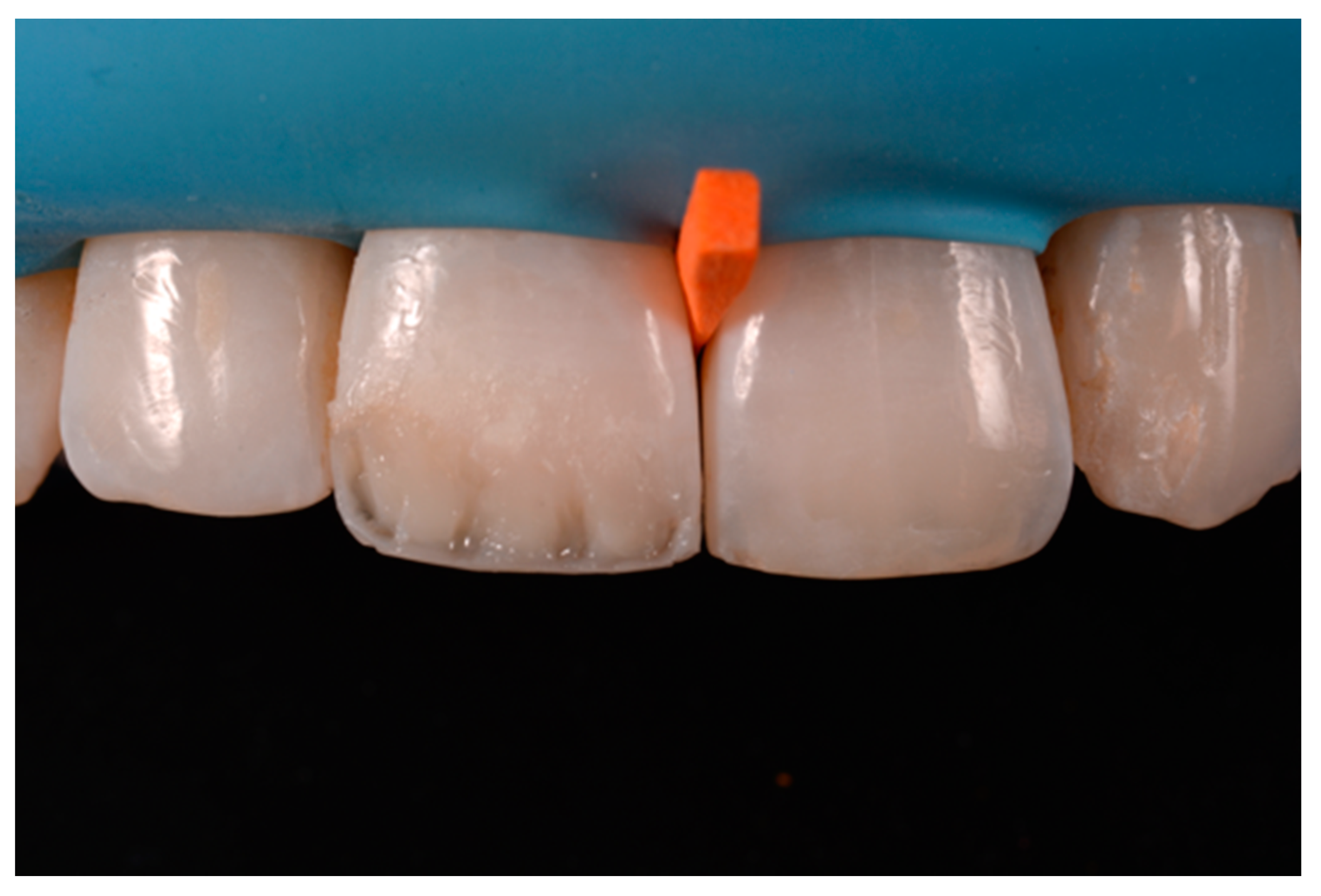 Dentistry 09 00079 g054 550