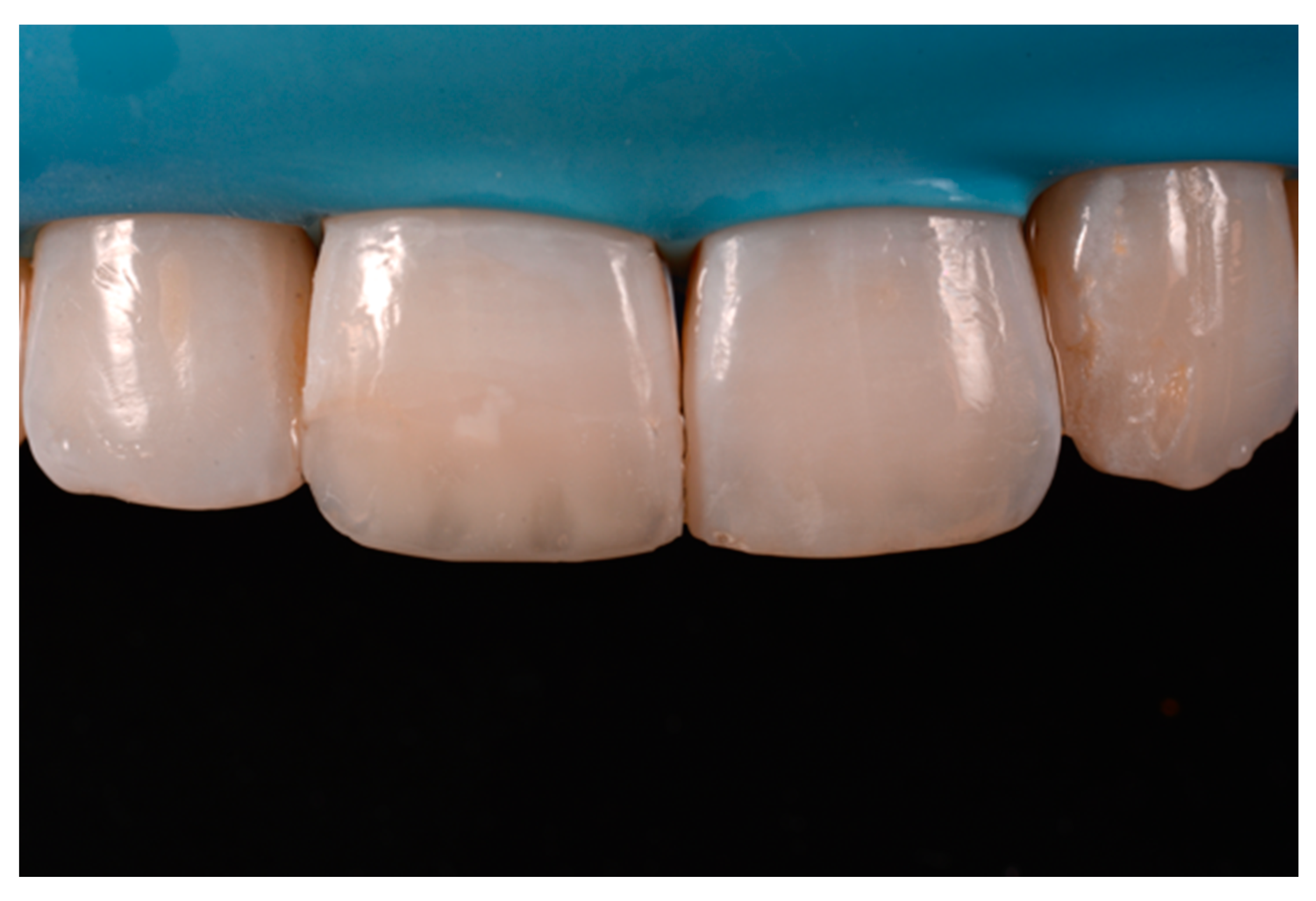 Dentistry 09 00079 g056 550