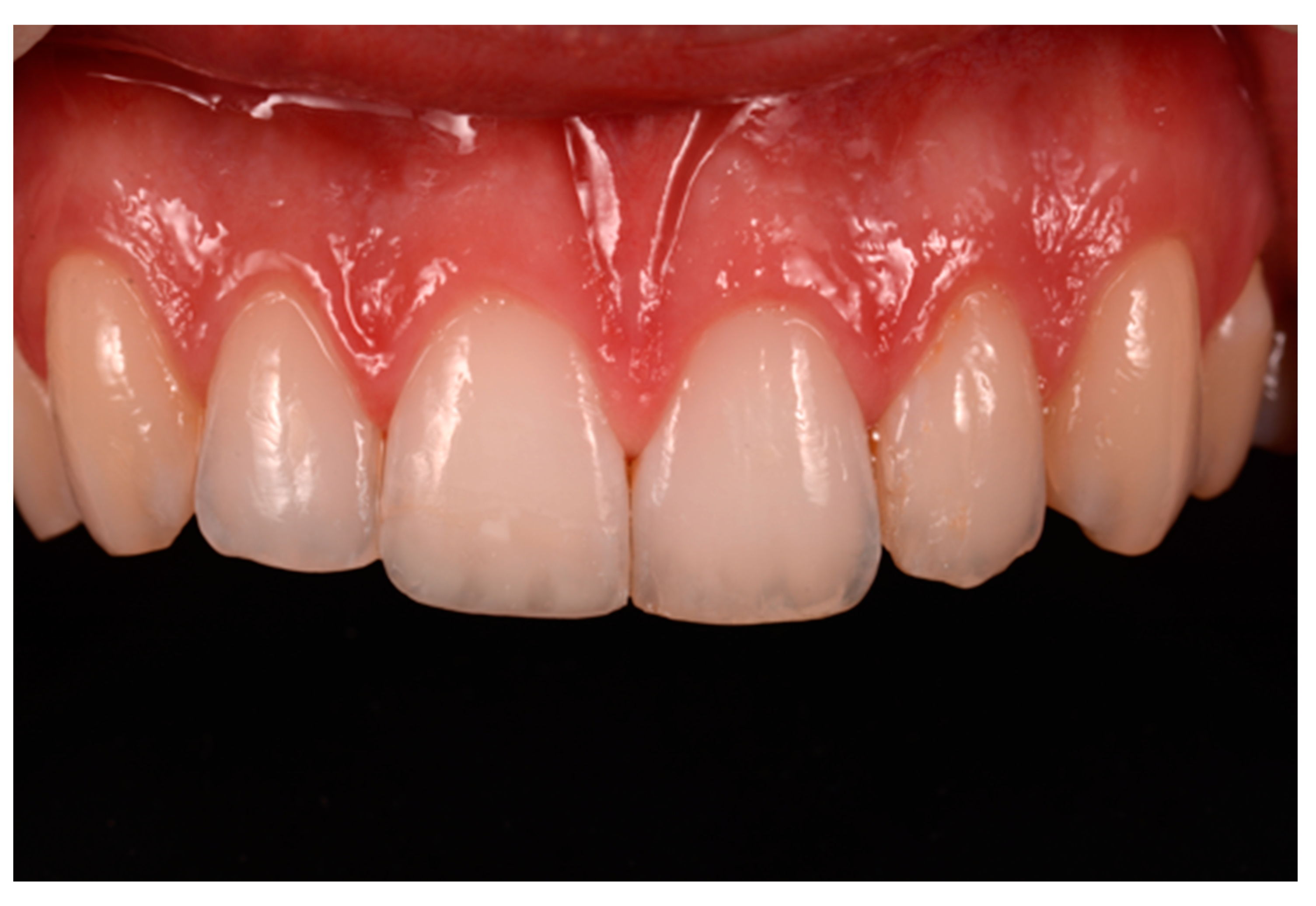 Dentistry 09 00079 g057 550