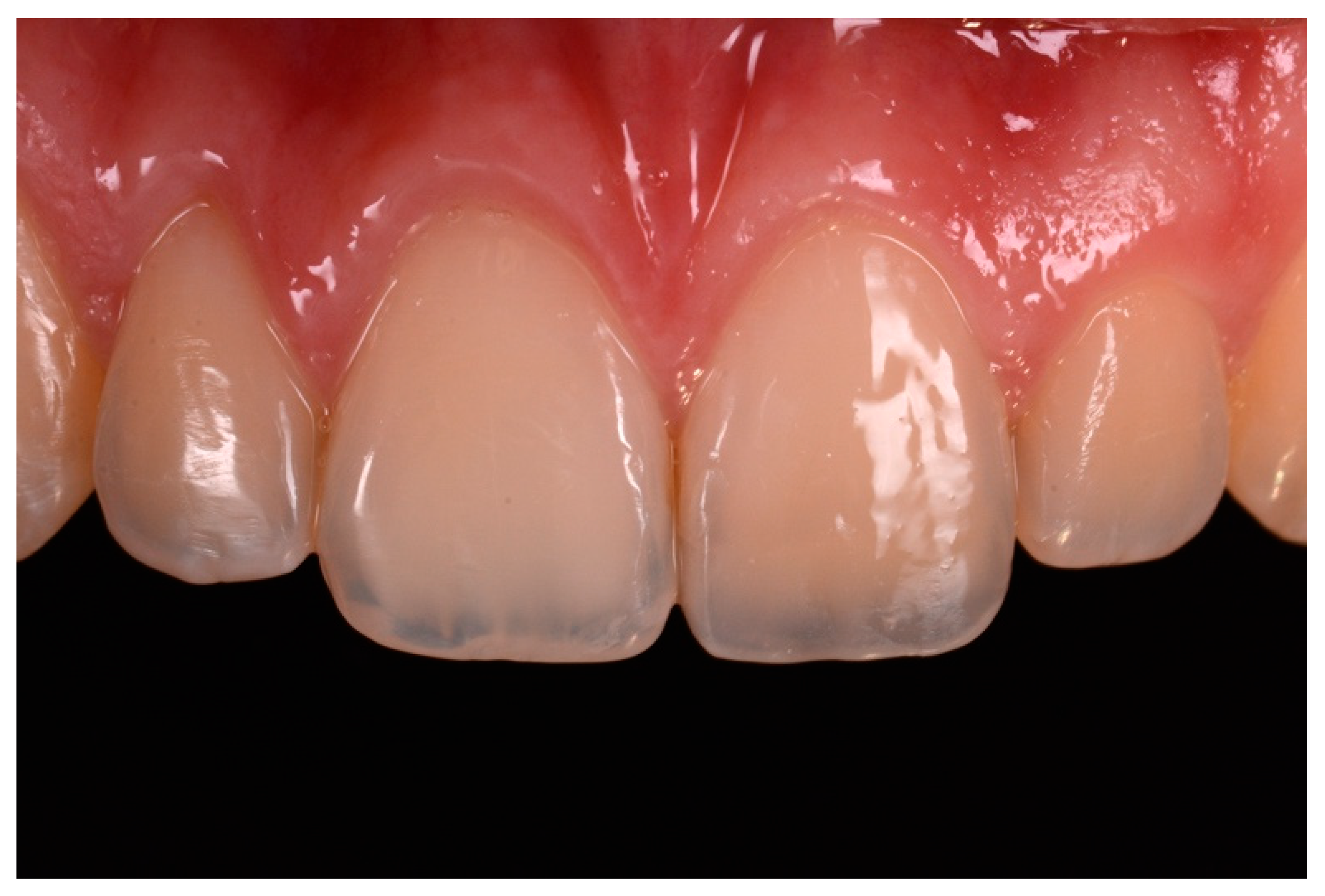 Dentistry 09 00079 g058 550